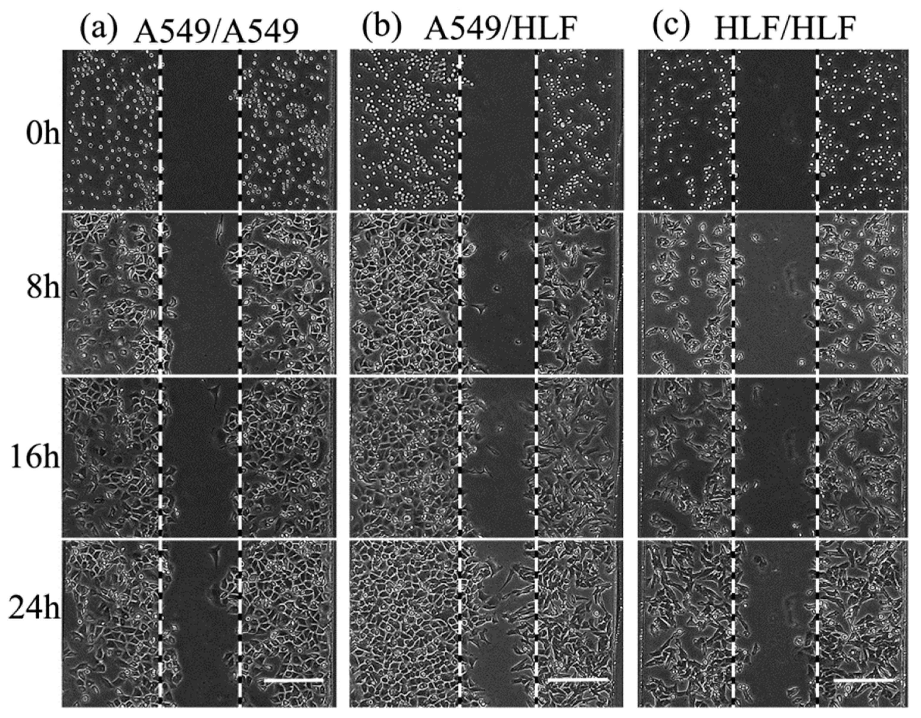 Micromachines 09 00665 g005