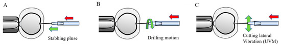 A Review of Automated Microinjection of Zebrafish Embryos