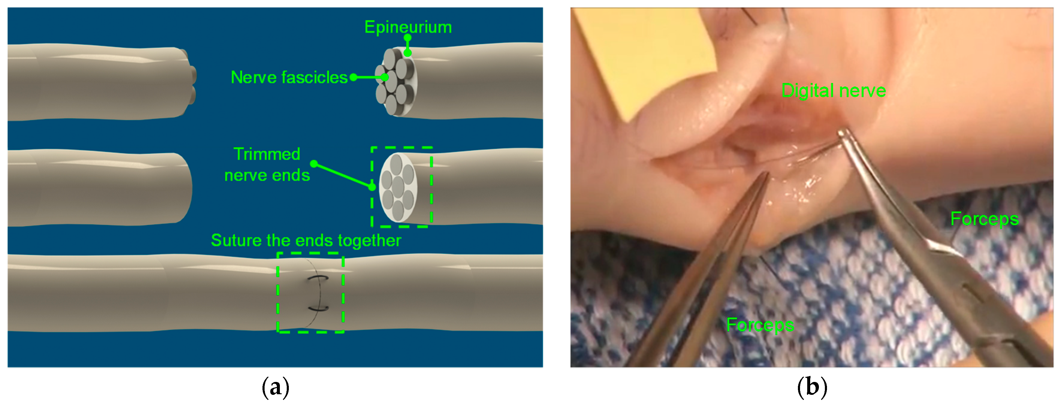 Micromachines 10 00190 g001 550