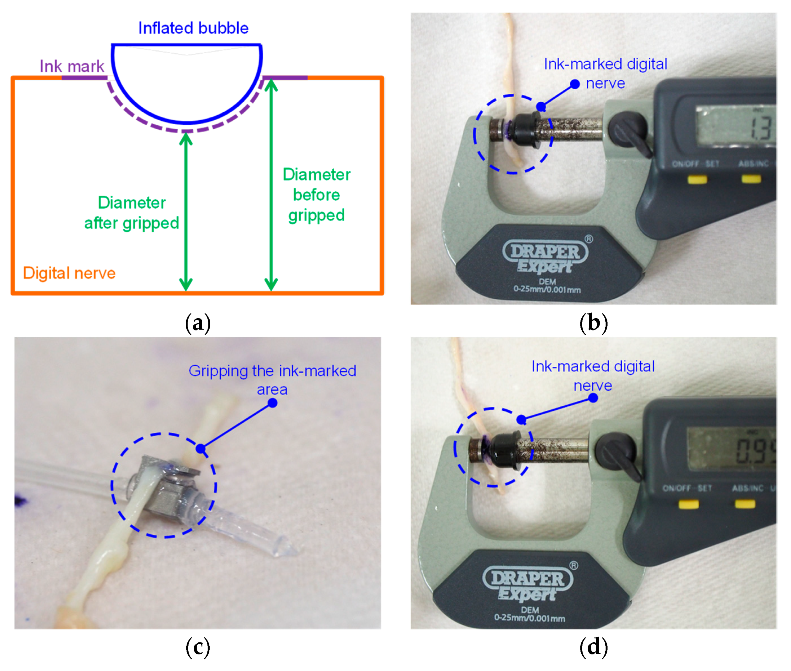 Micromachines 10 00190 g011 550