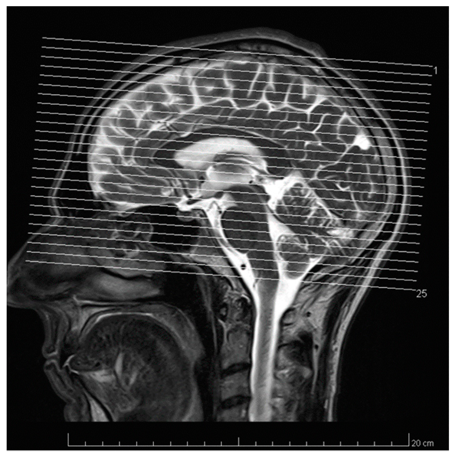 Micromachines 10 00292 g005 Micromachines 10 00292 g005