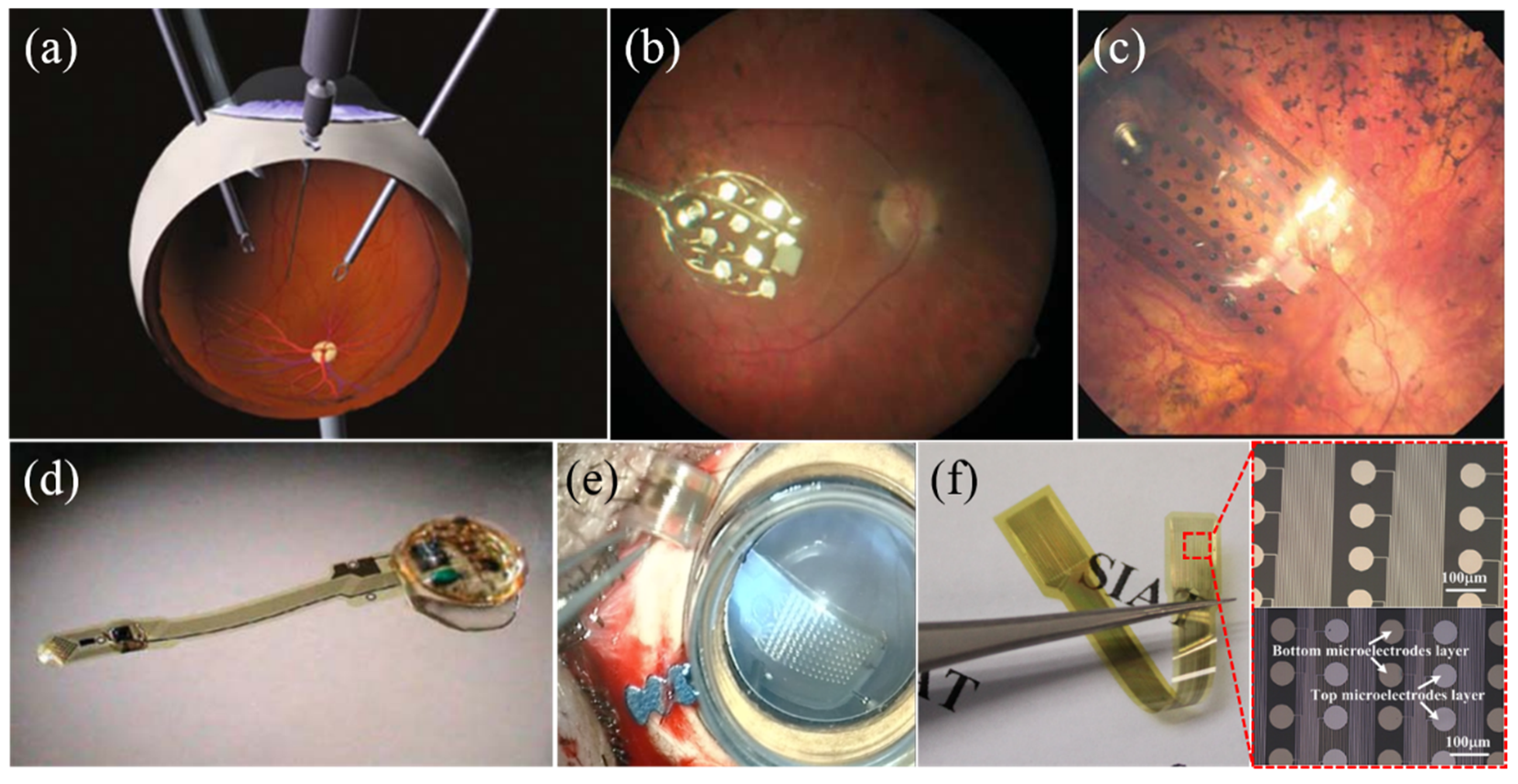 Micromachines 10 00419 g006 Micromachines 10 00419 g006