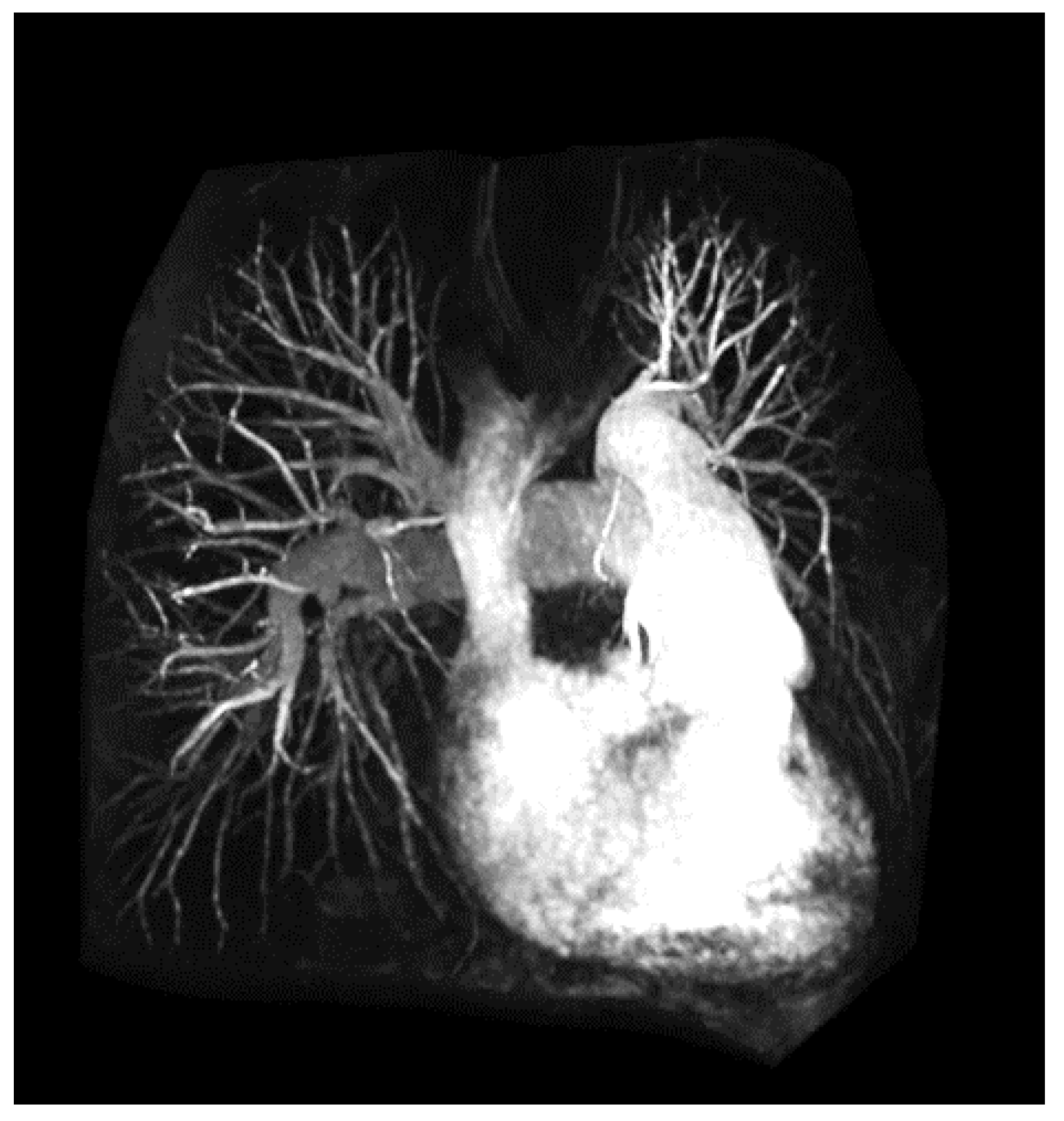 Micromachines 10 00474 g005 Micromachines 10 00474 g005