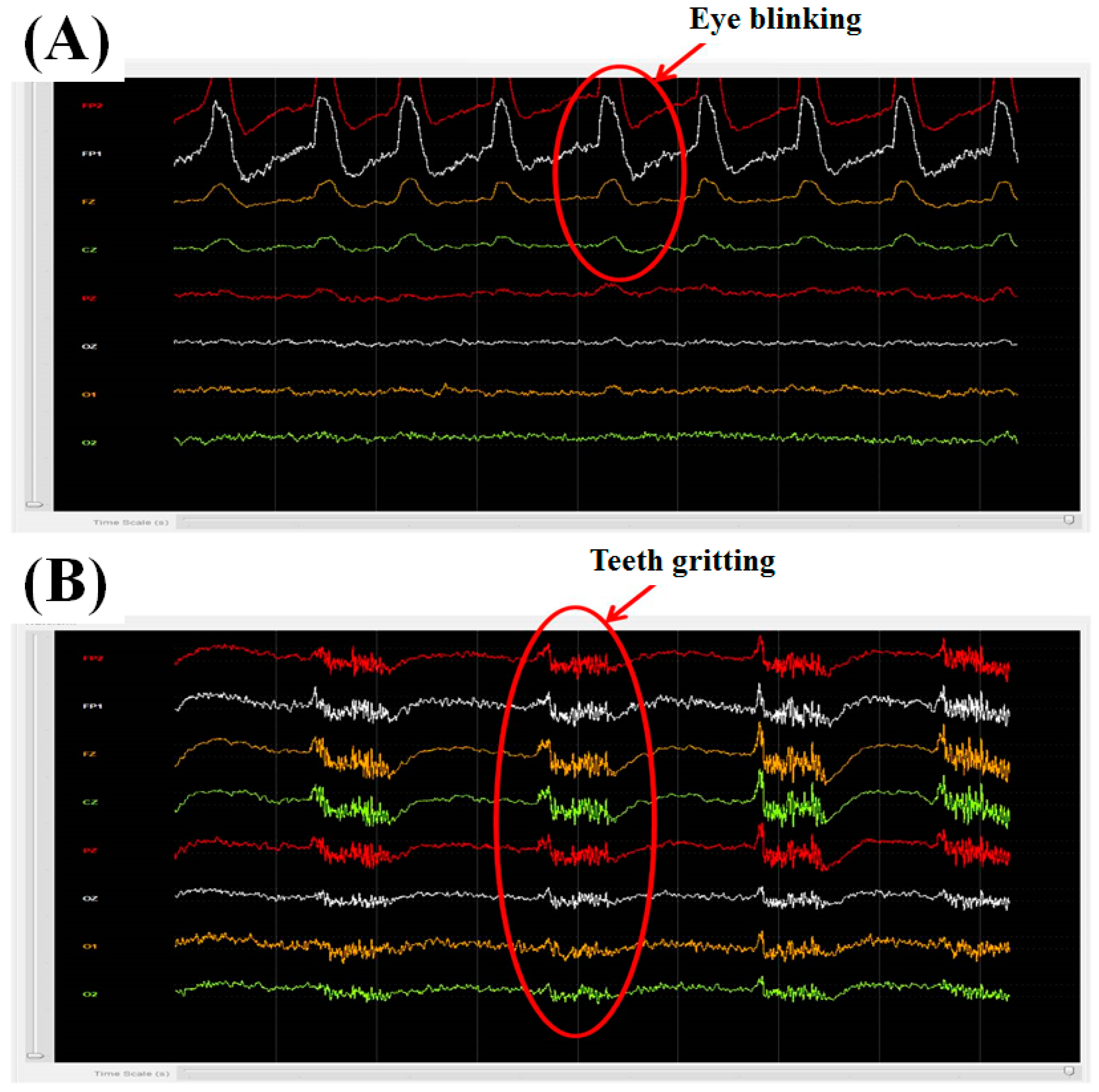 Micromachines 10 00720 g007 Micromachines 10 00720 g007