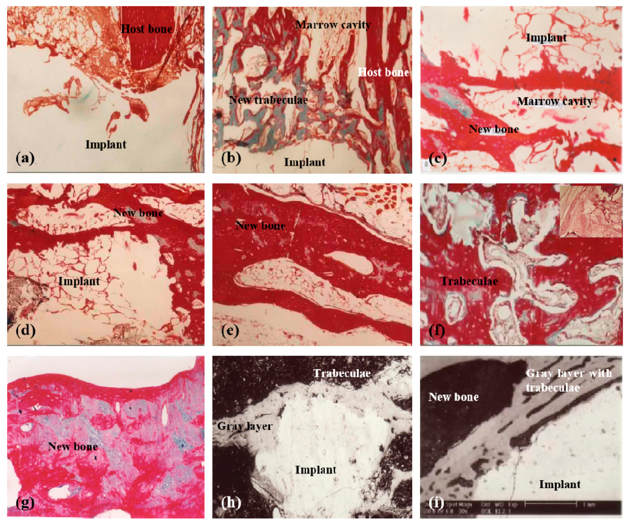 Micromachines 10 00765 g005 Micromachines 10 00765 g005