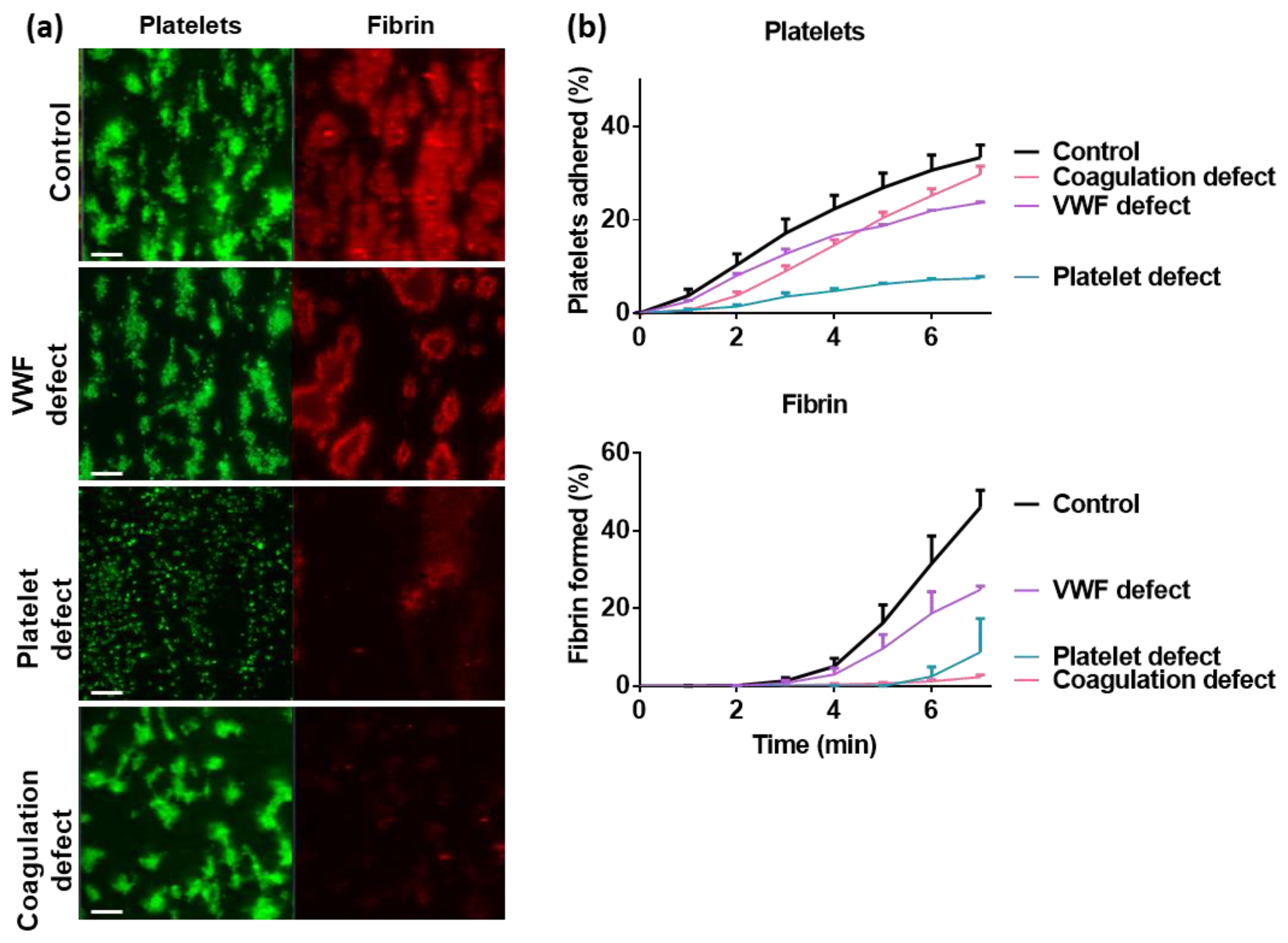 Micromachines 10 00787 g003