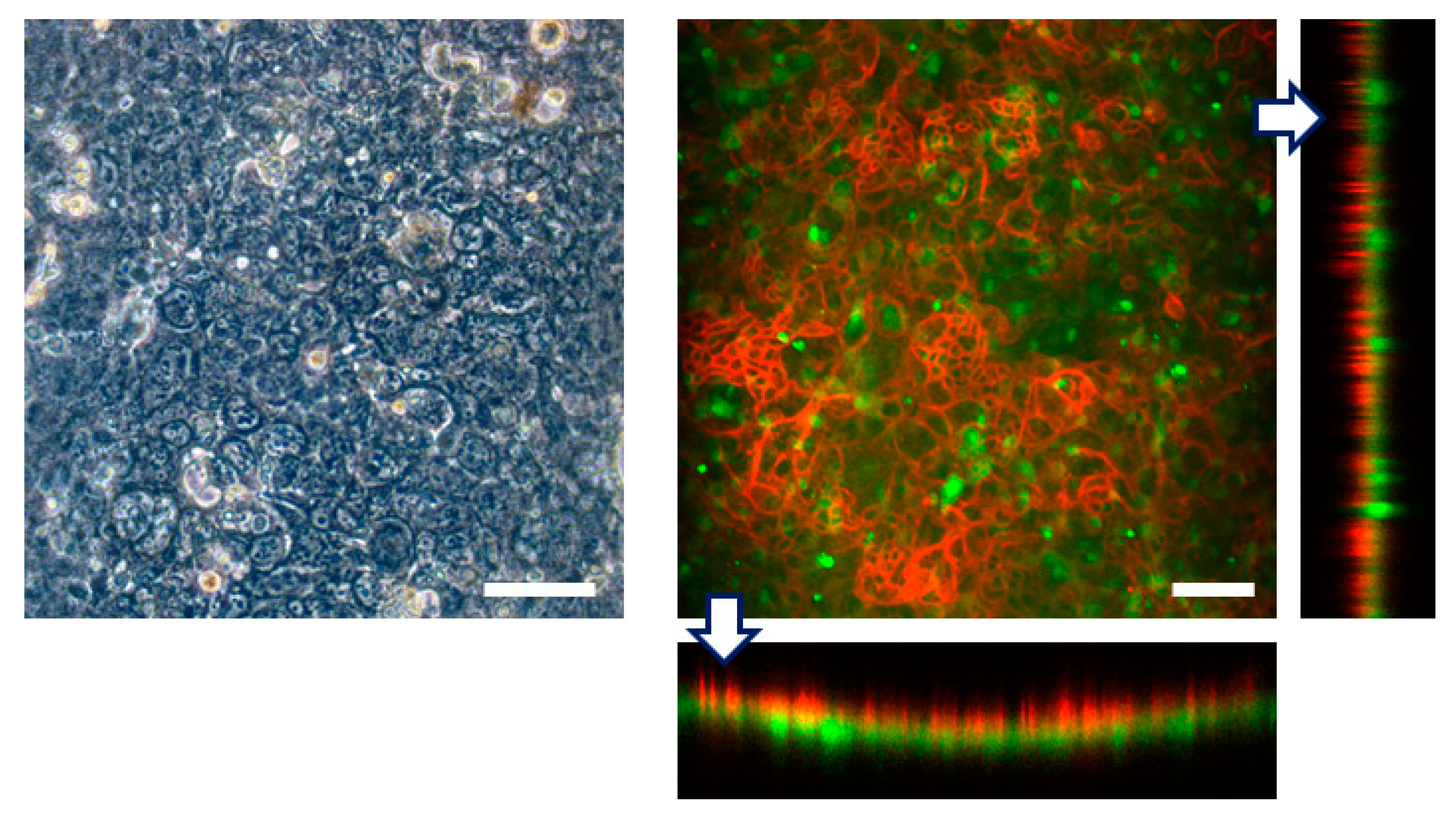 Micromachines 10 00793 g006