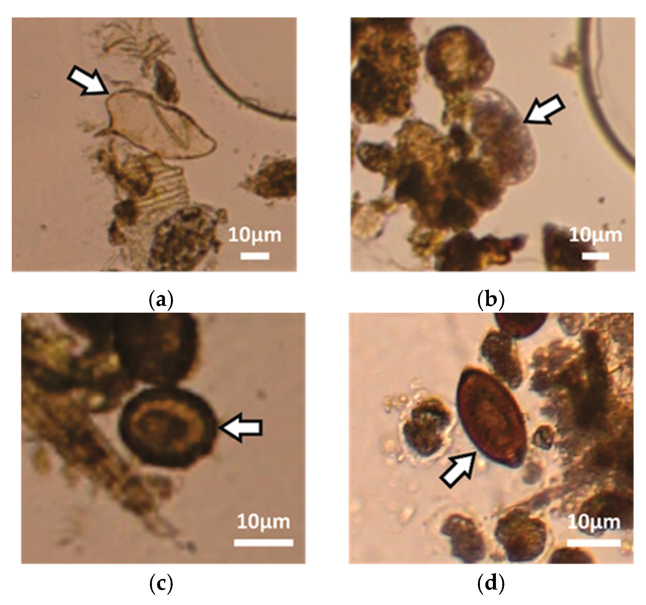 parasite eggs in stool