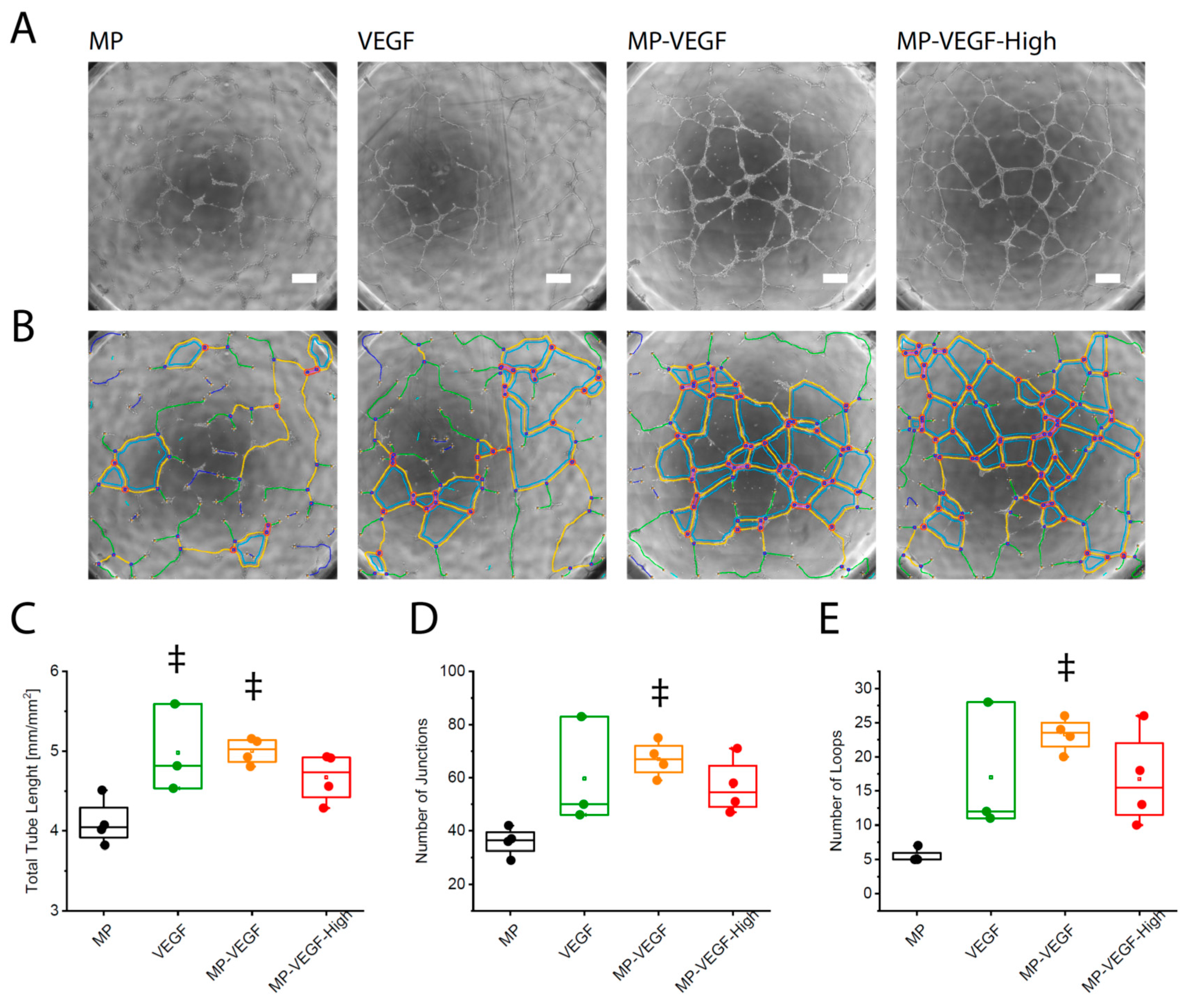 Micromachines 11 00158 g003