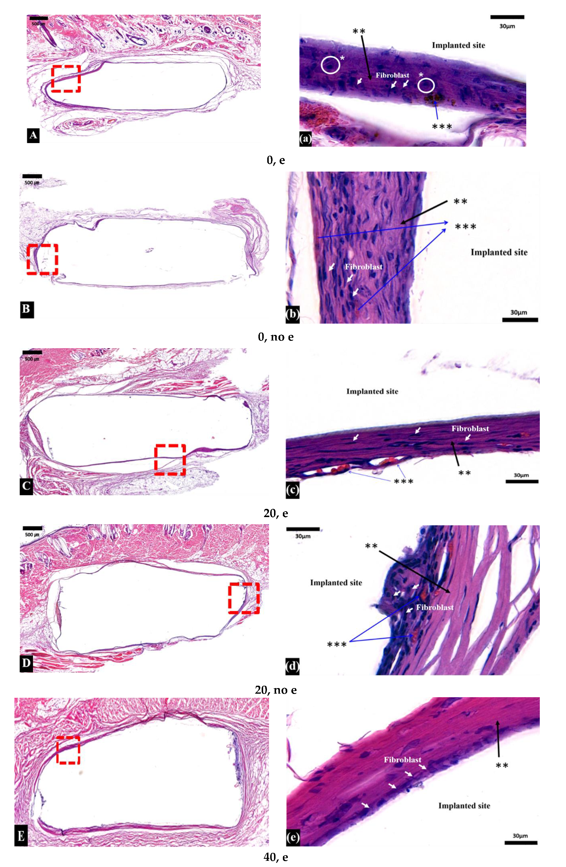 Micromachines 11 00273 g004a Micromachines 11 00273 g004a