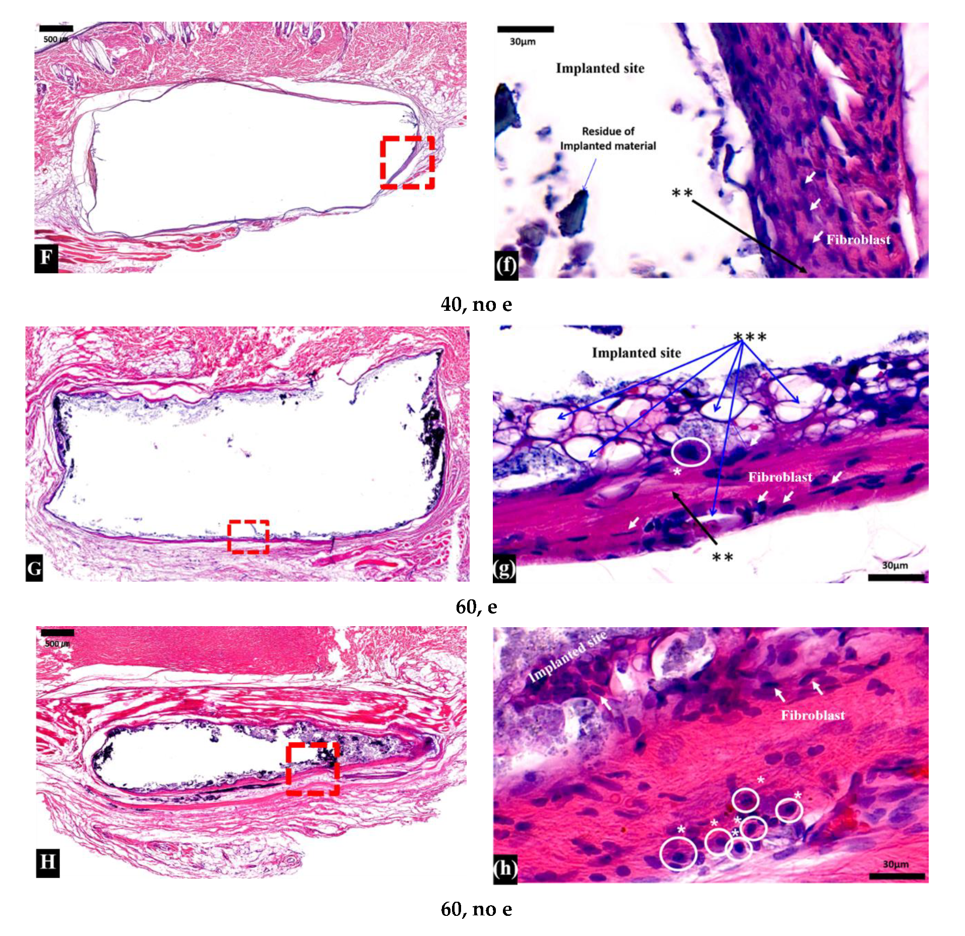 Micromachines 11 00273 g004b Micromachines 11 00273 g004b