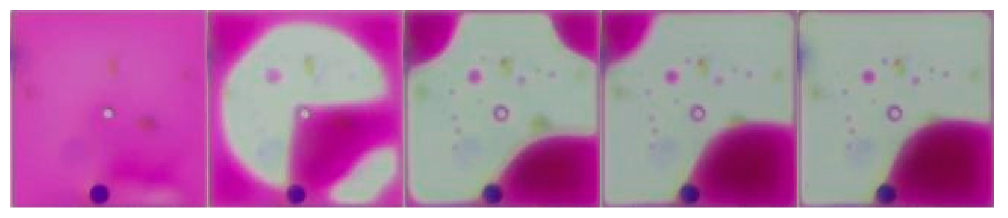 Micromachines 11 00313 g005