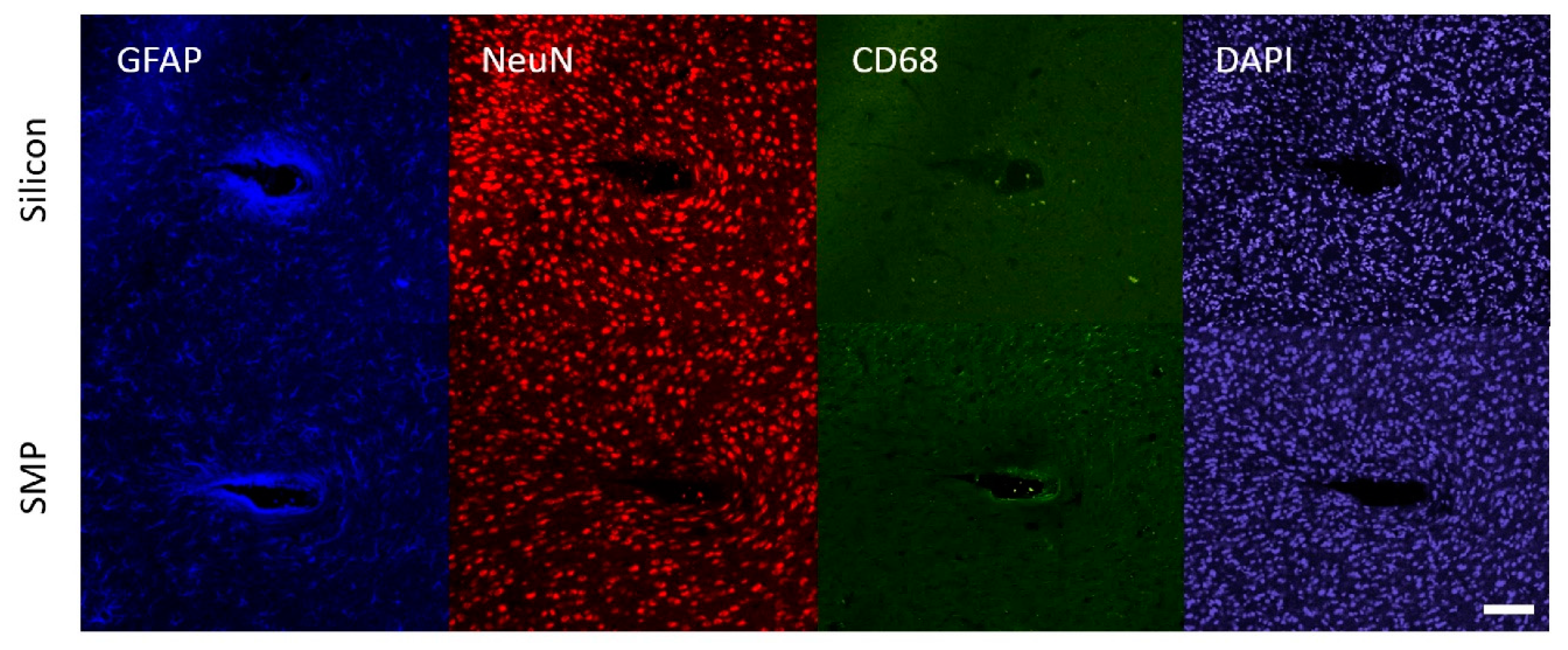 Micromachines 11 00619 g008 Micromachines 11 00619 g008