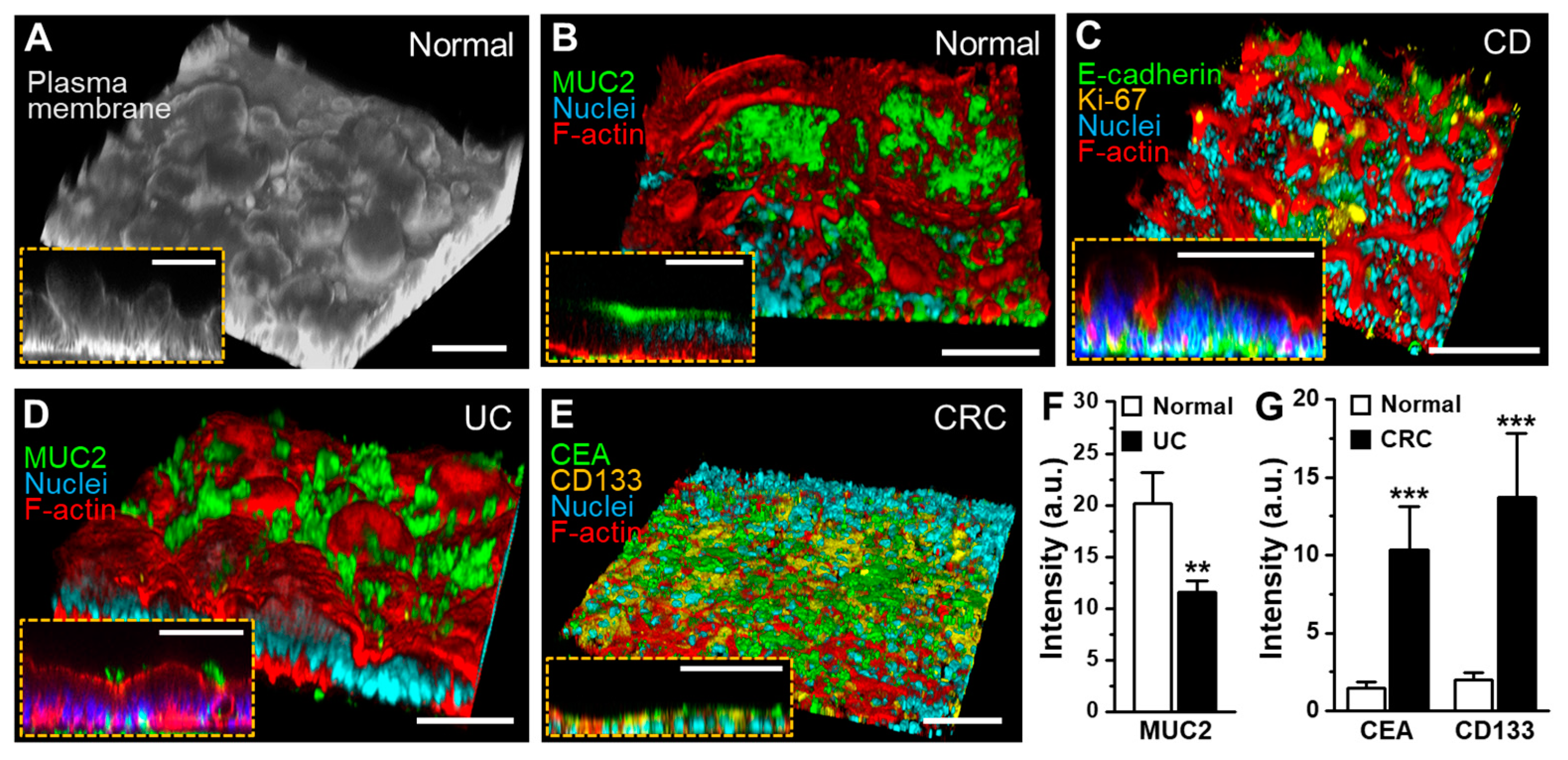 Micromachines 11 00663 g005