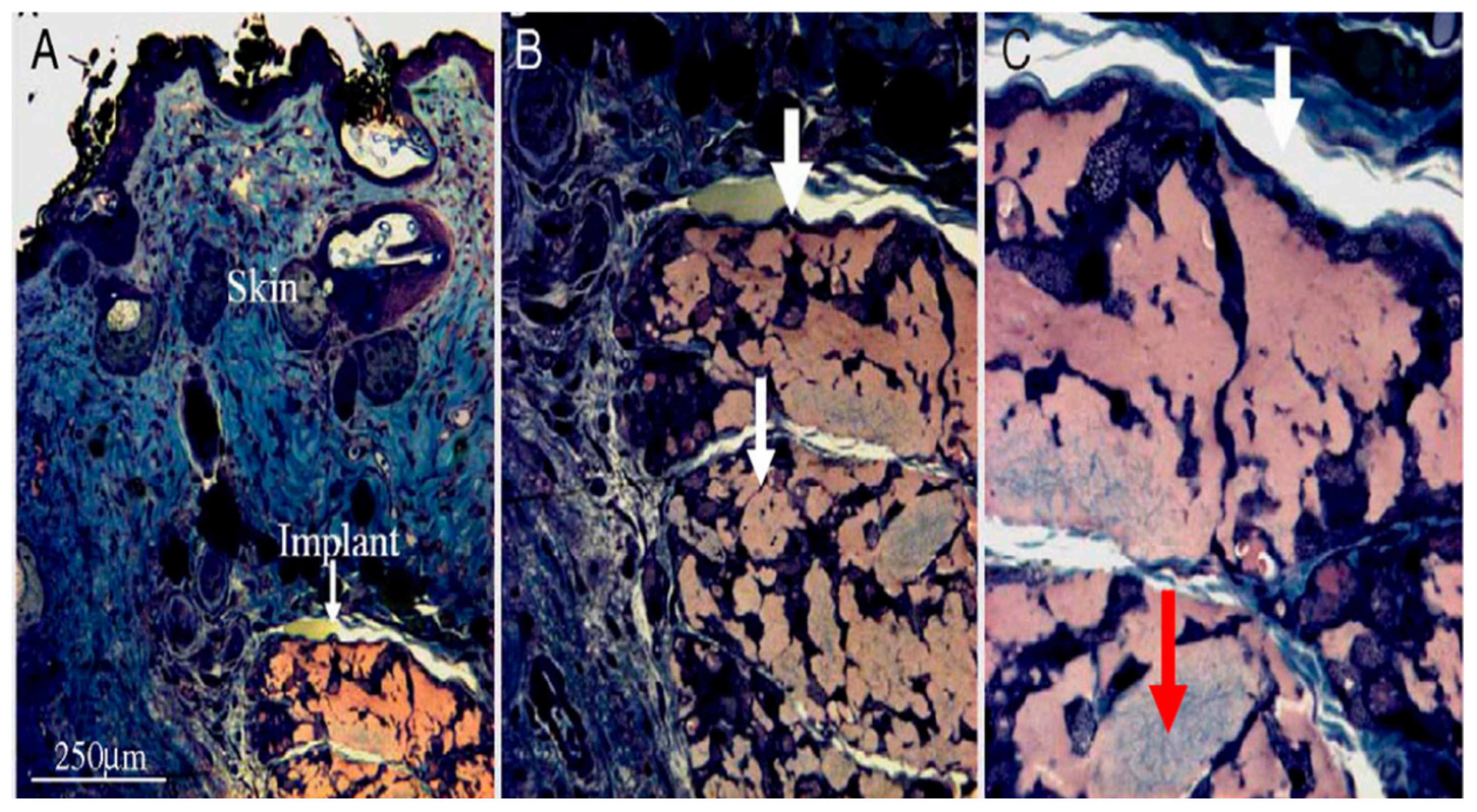 Micromachines 11 00797 g011 Micromachines 11 00797 g011
