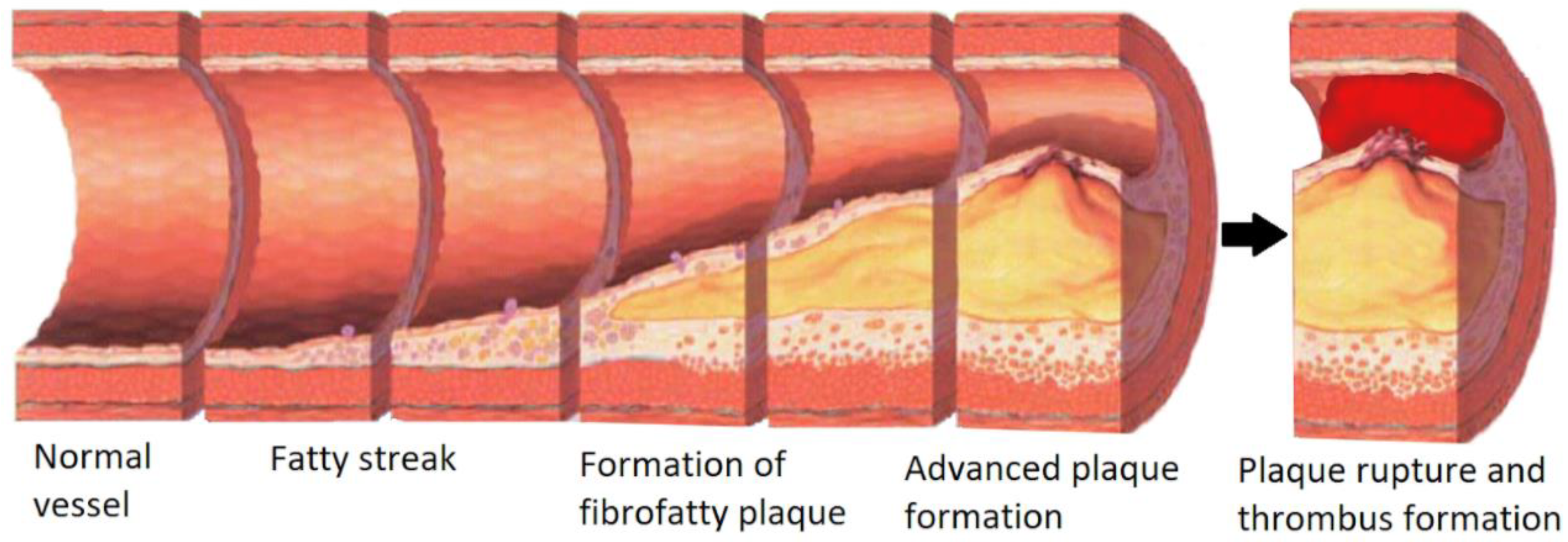 Micromachines 11 00898 g001 Micromachines 11 00898 g001