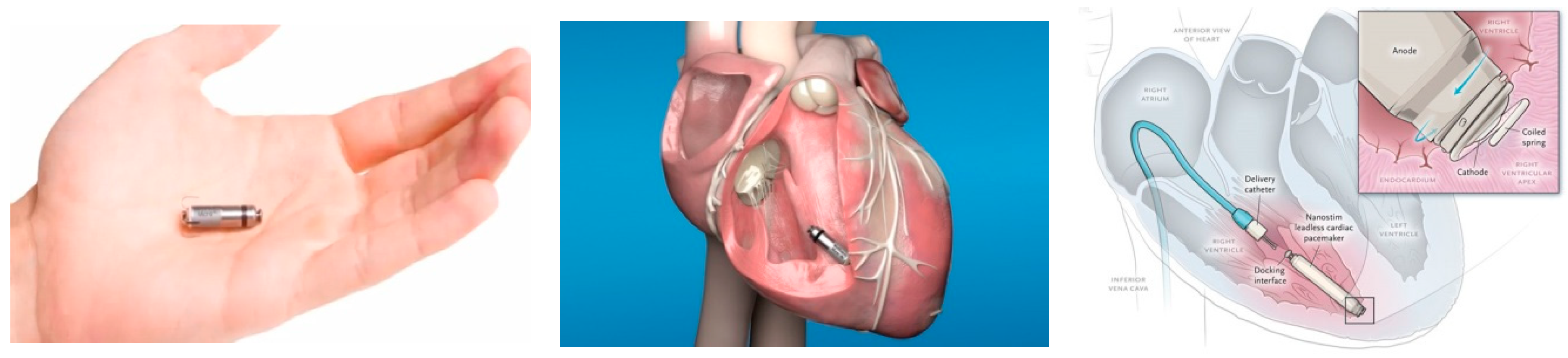 Micromachines 11 00902 g003 Micromachines 11 00902 g003