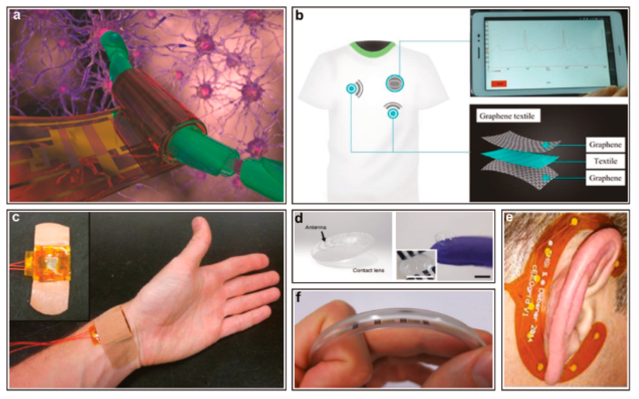Micromachines 12 00078 g005