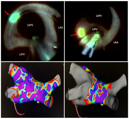 Micromachines Free FullText Clinical Applications of Laser