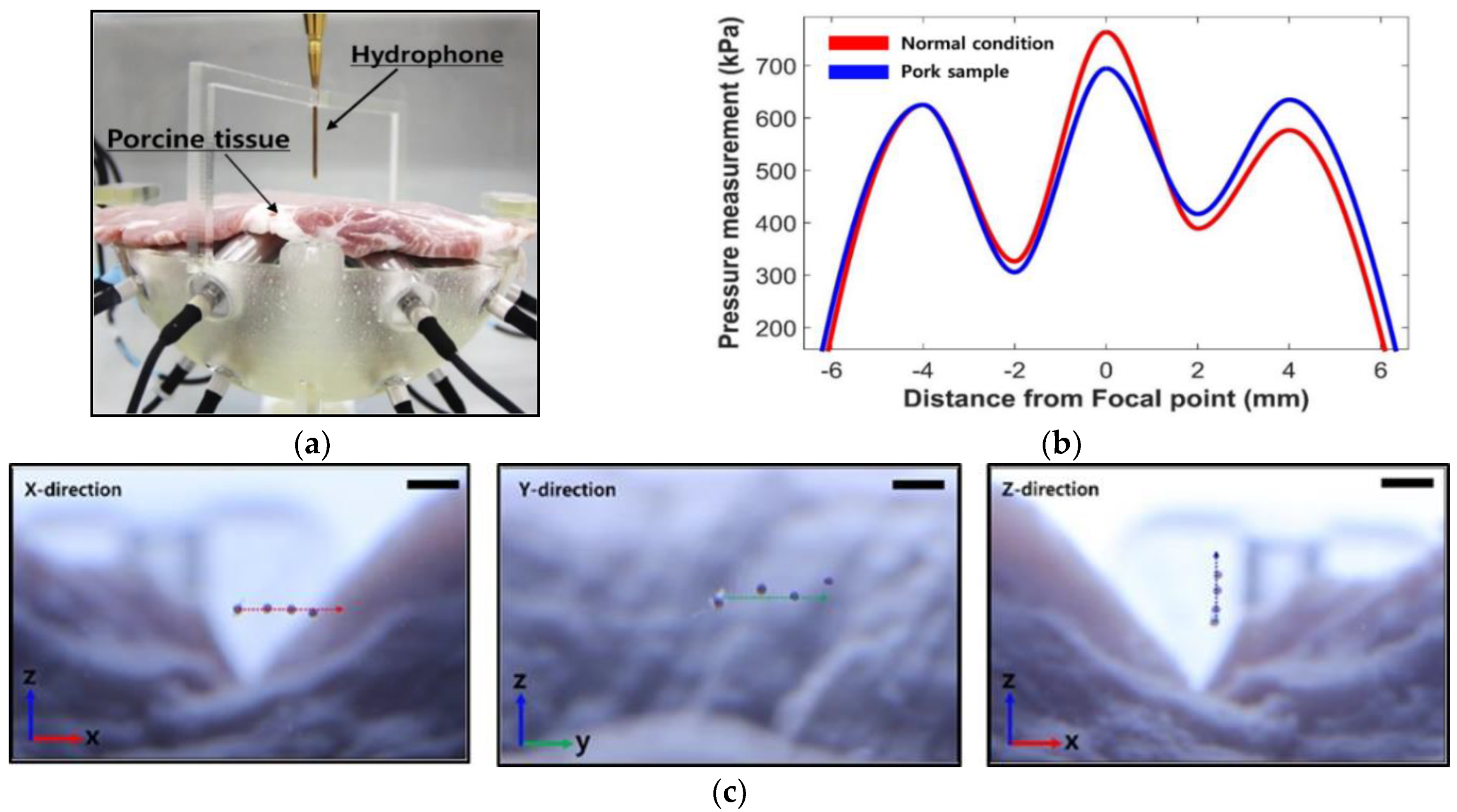 Micromachines 12 00192 g011