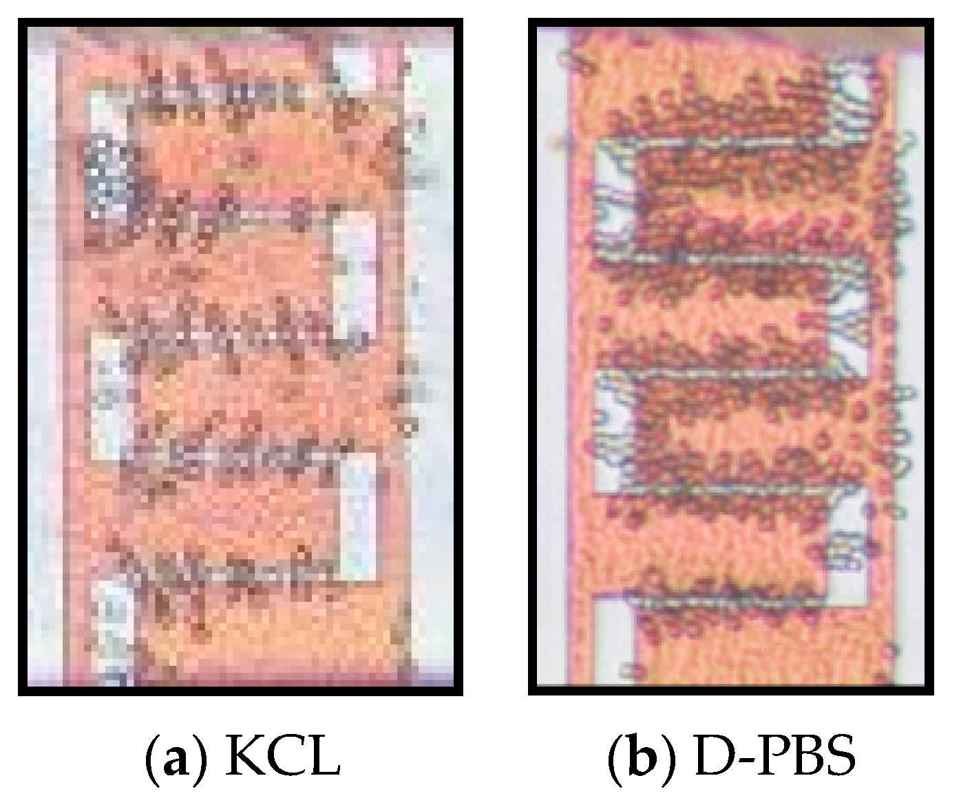 Micromachines 12 00270 g011