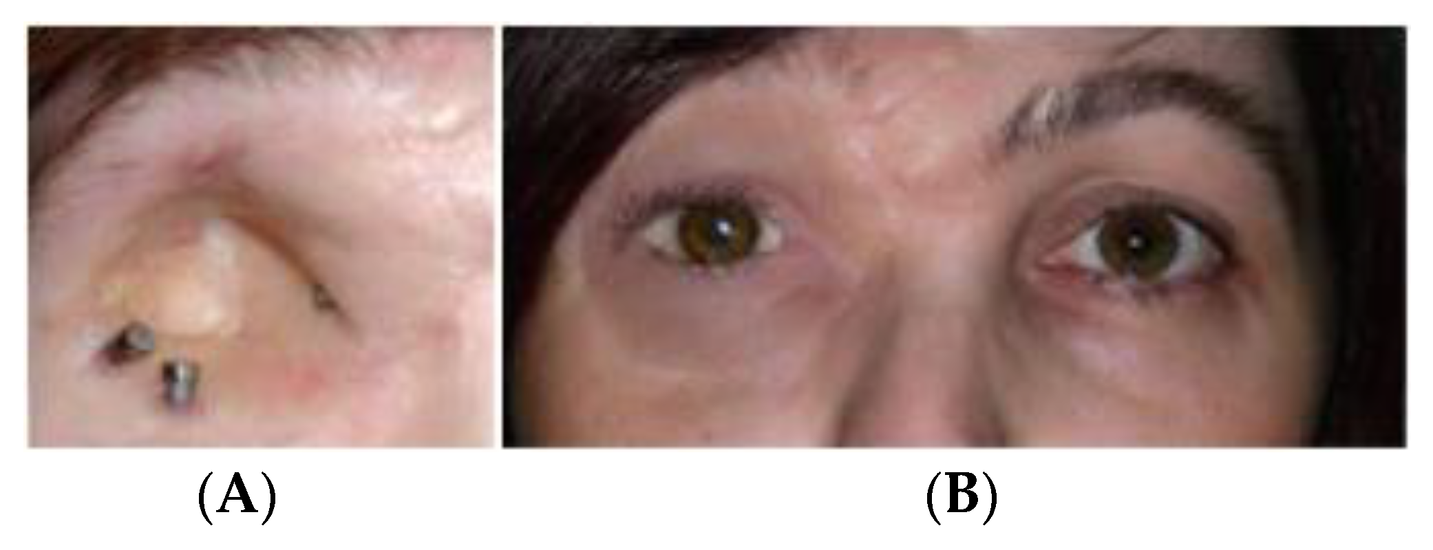 Micromachines 12 00298 g001 Micromachines 12 00298 g001