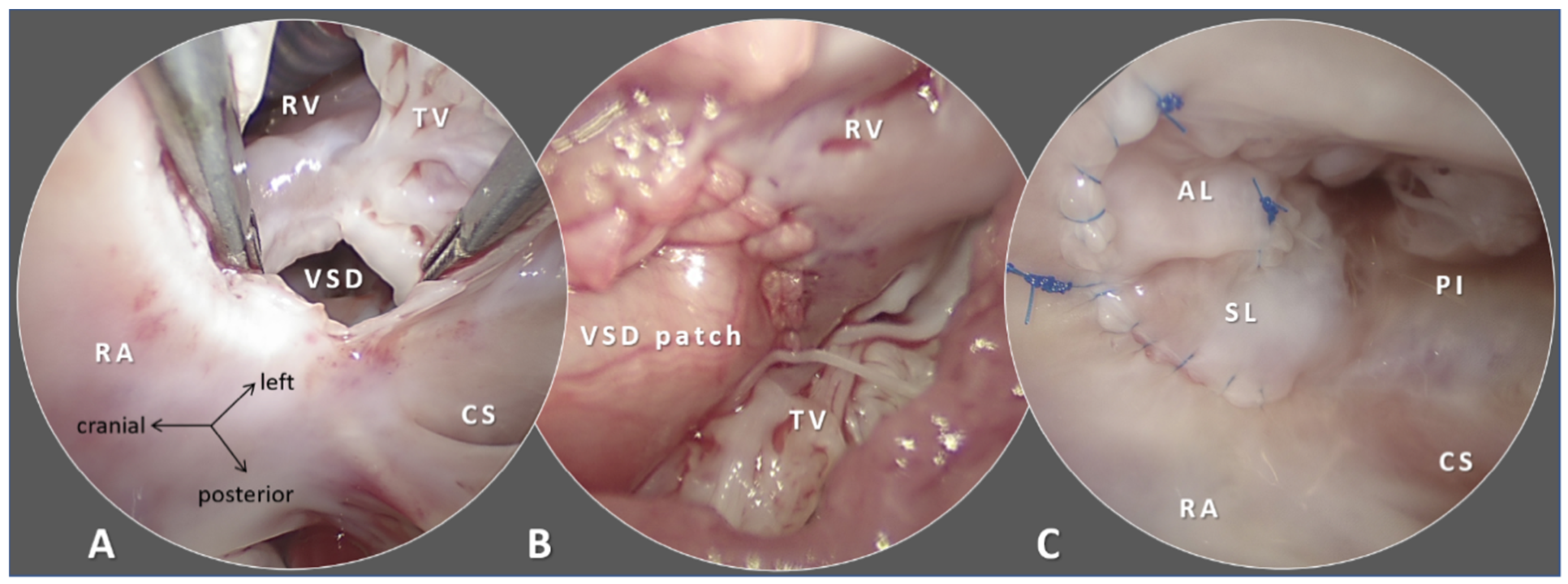 Micromachines 12 00332 g002 Micromachines 12 00332 g002