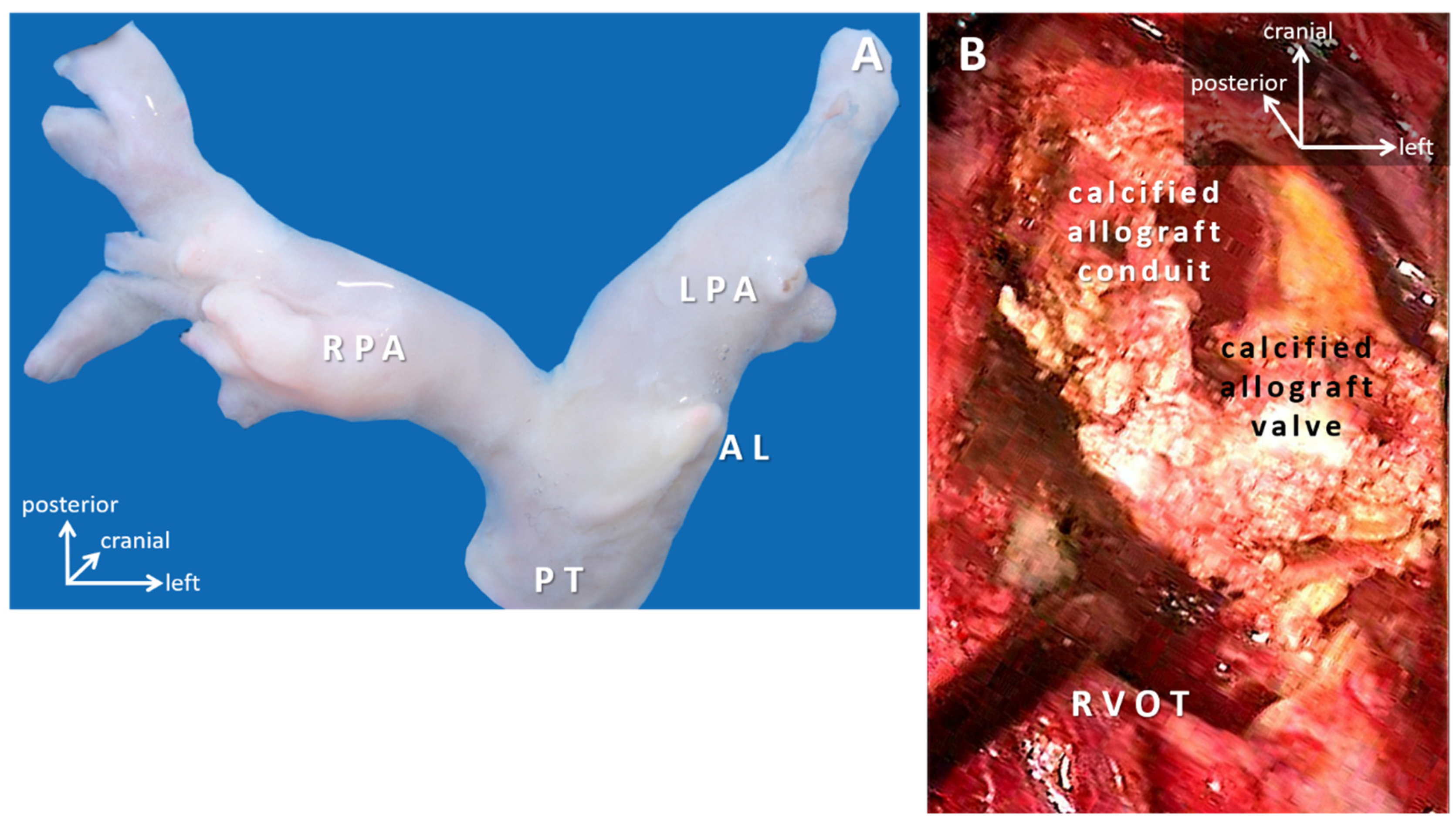 Micromachines 12 00332 g005 Micromachines 12 00332 g005