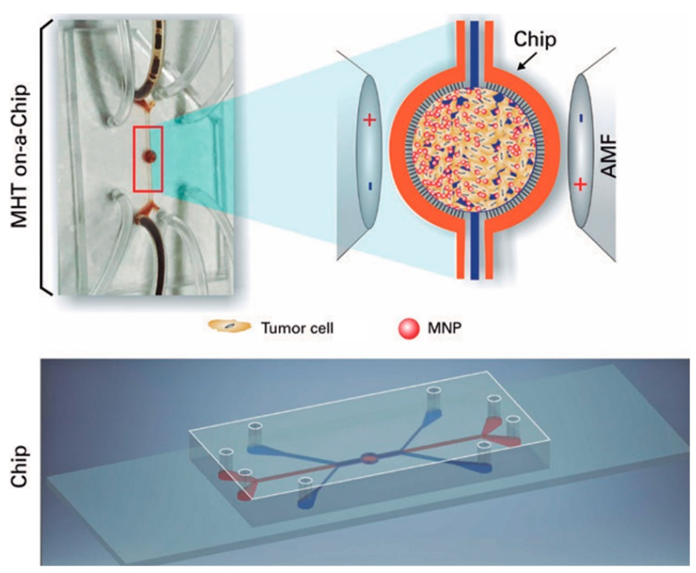 cip magnetic de la forumul prostatitei