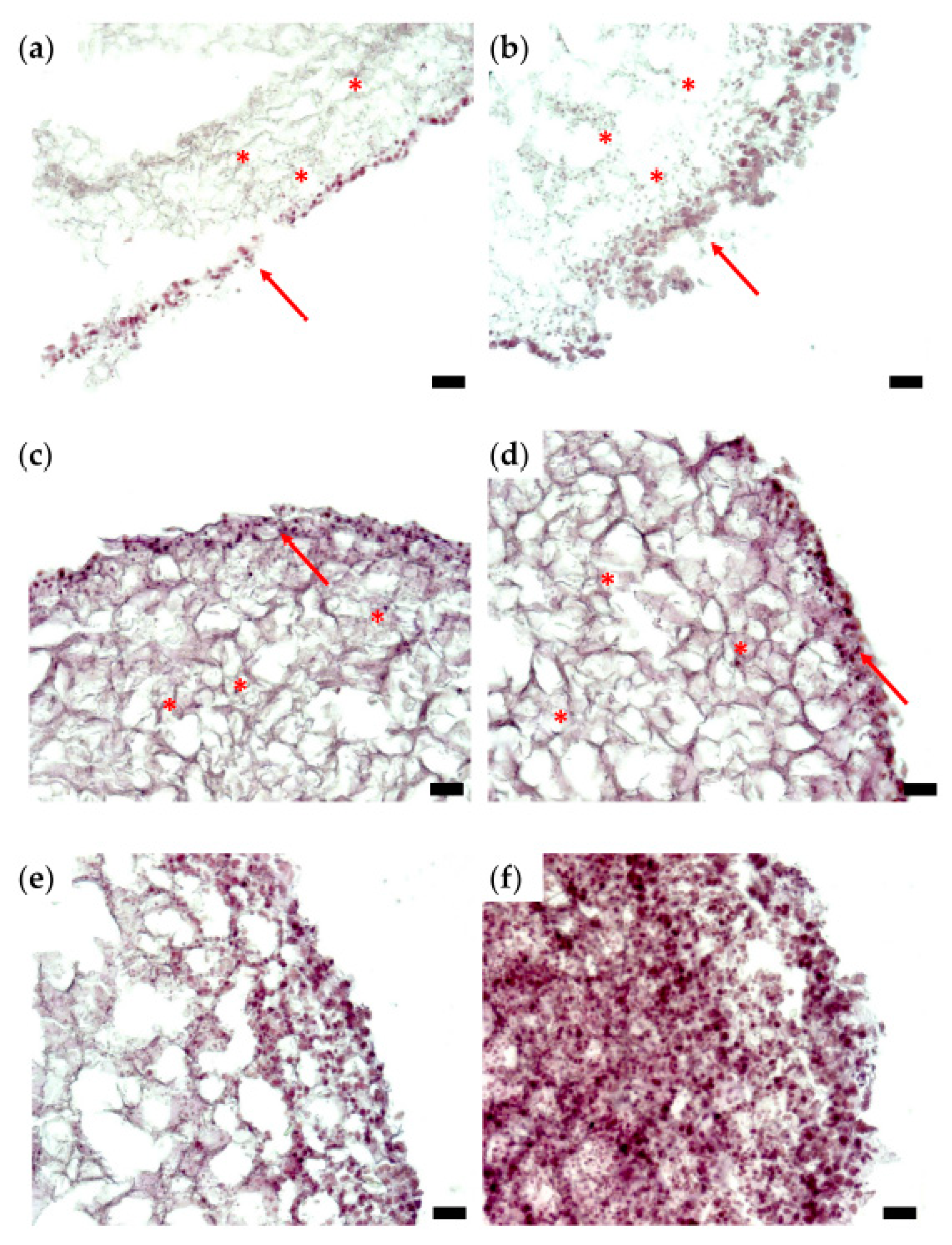 Micromachines 12 00535 g005