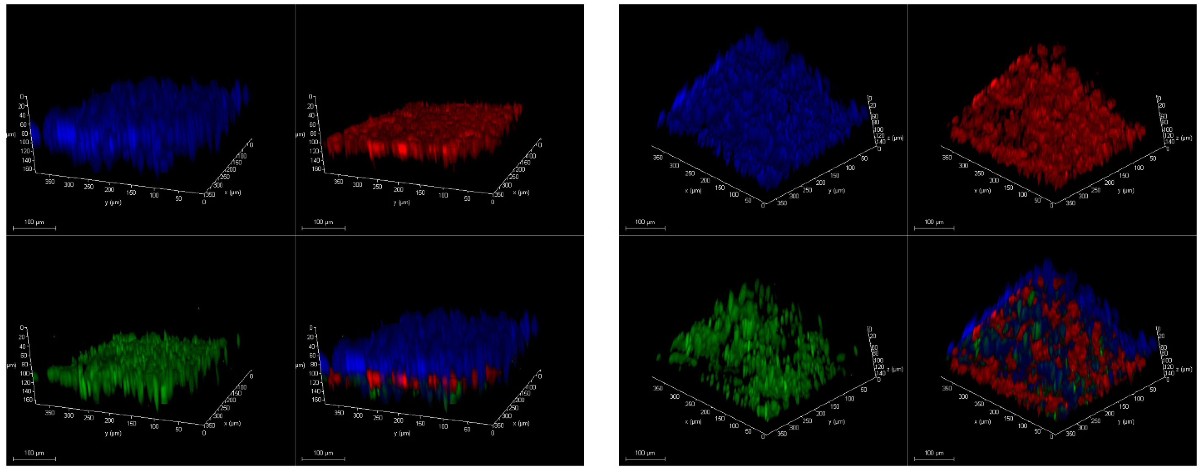 Micromachines 12 00546 g005
