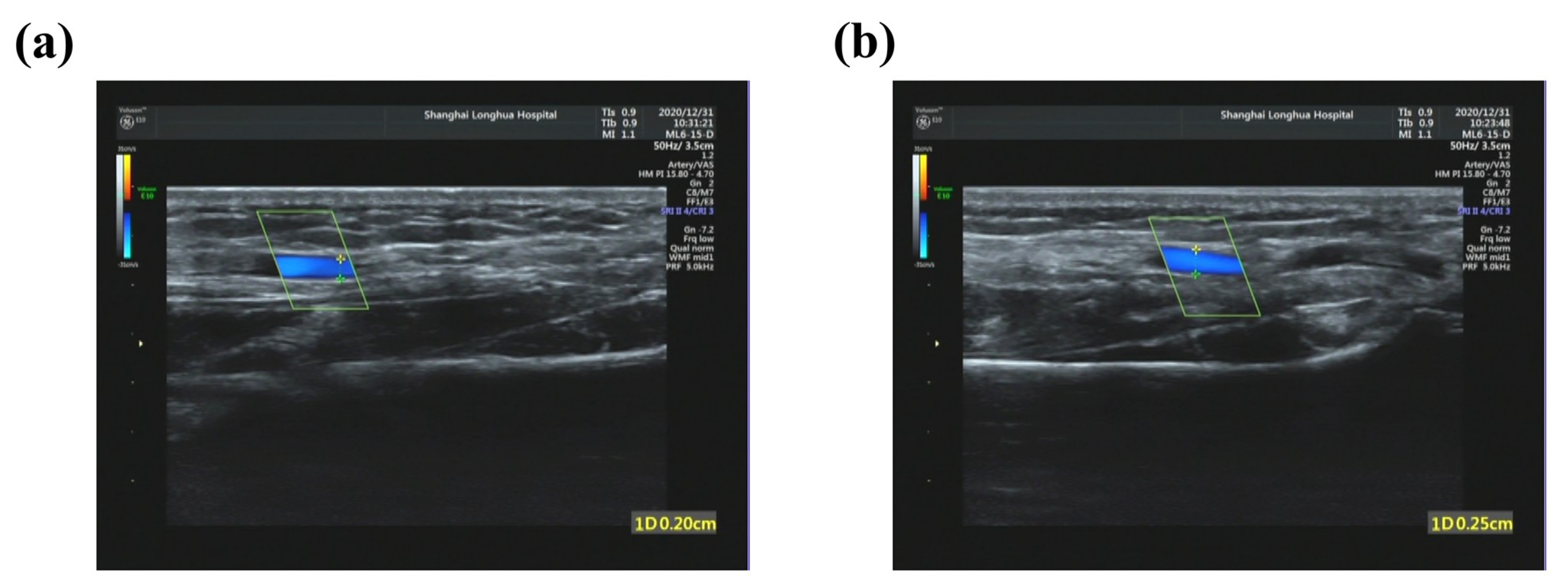 Micromachines 12 00569 g015
