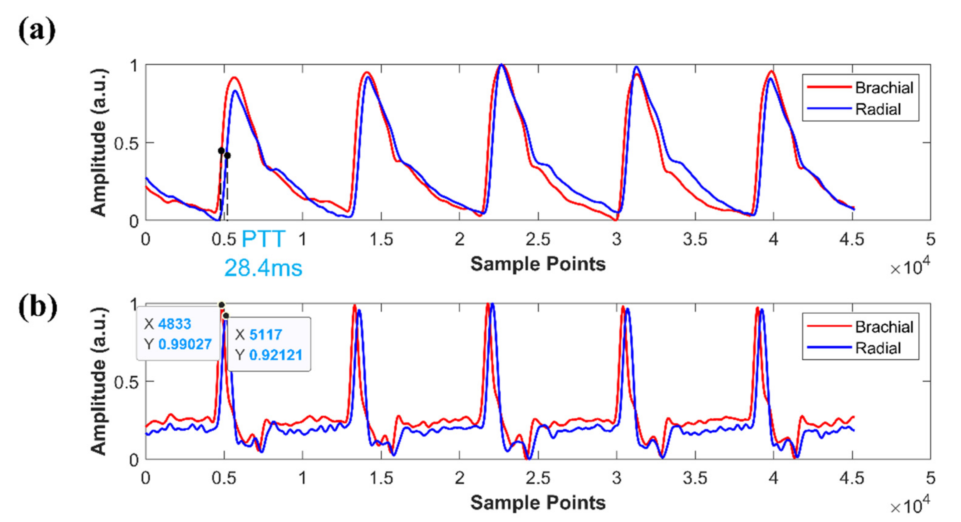 Micromachines 12 00569 g016