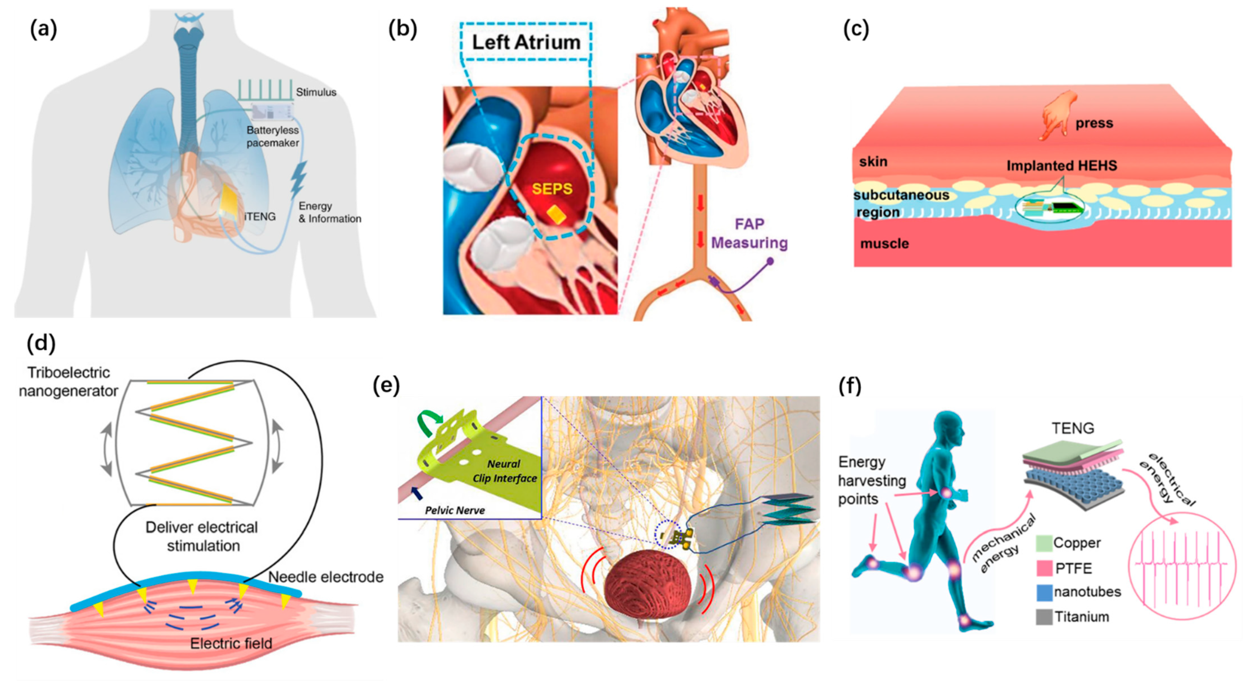 Micromachines 12 00666 g008 Micromachines 12 00666 g008