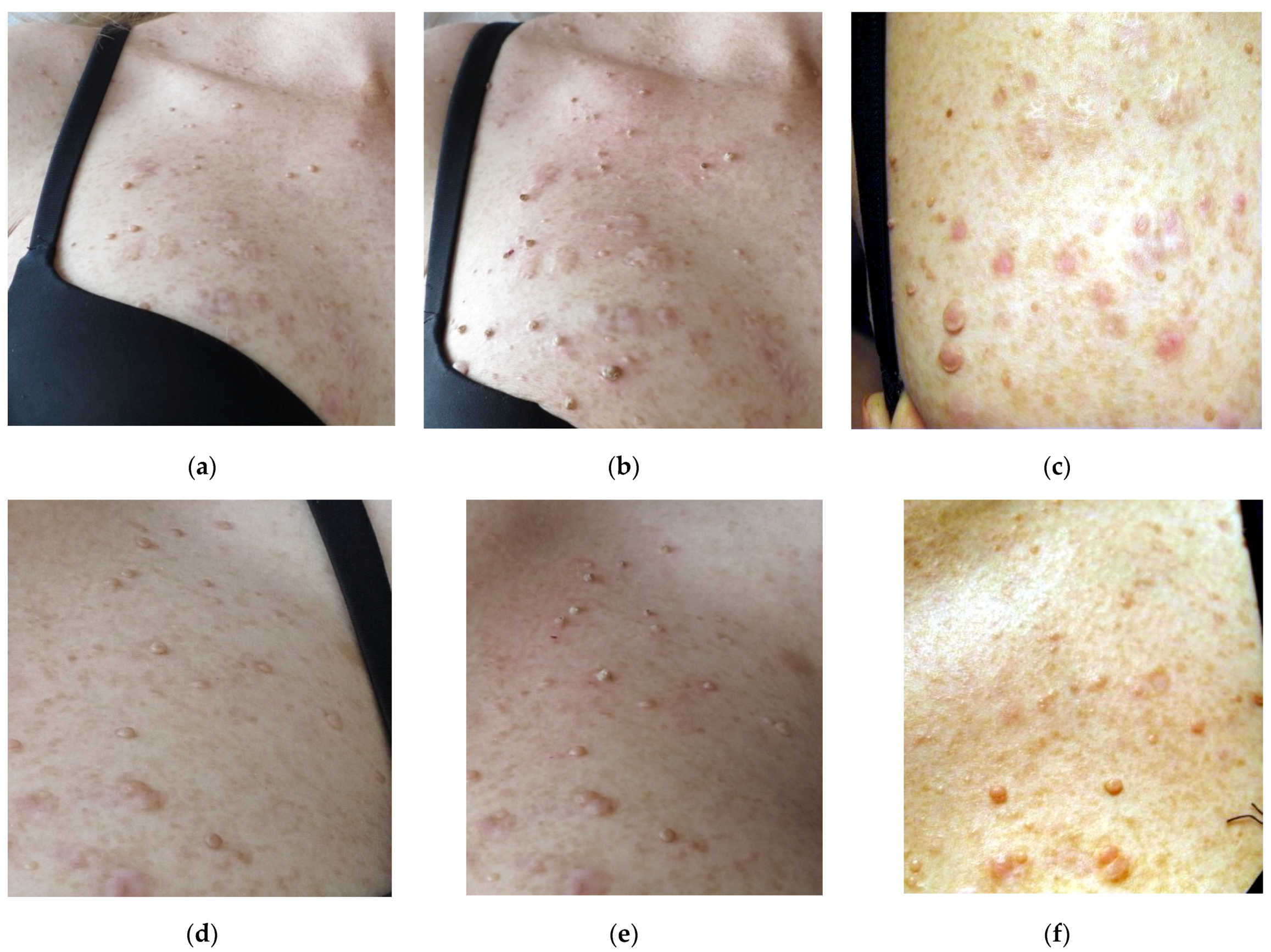 Micromachines 12 00710 g007 Micromachines 12 00710 g007