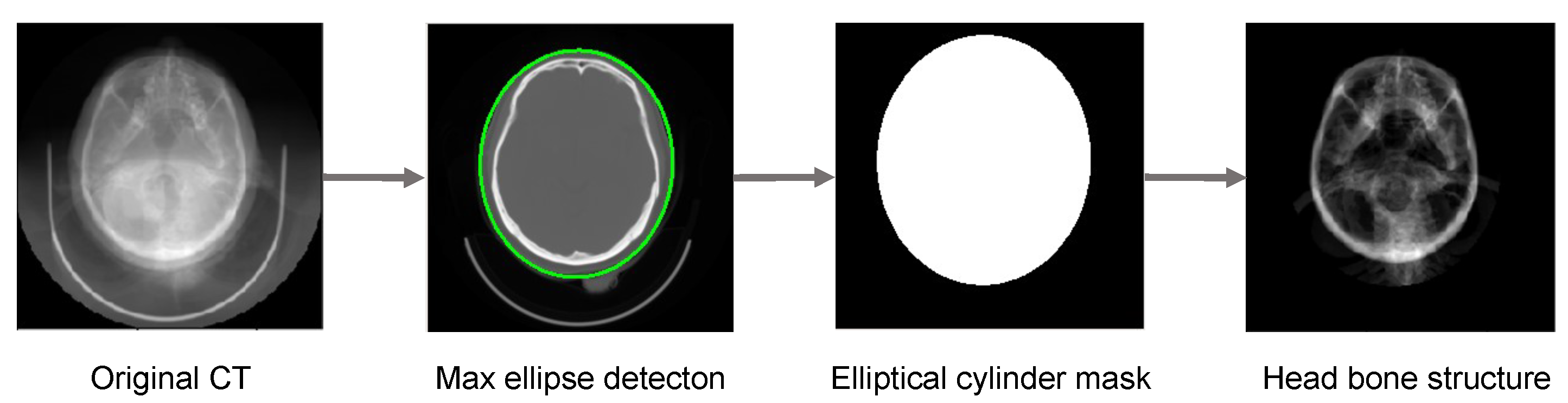 Micromachines 12 00844 g004