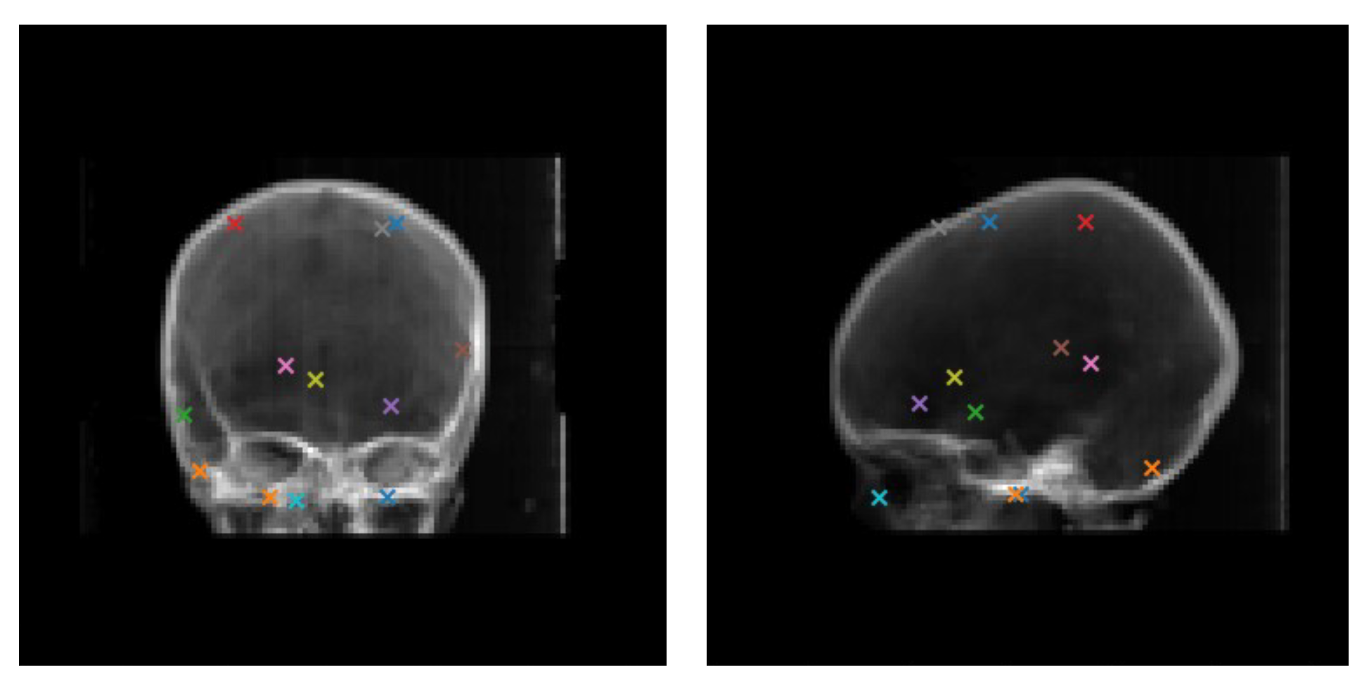 Micromachines 12 00844 g005