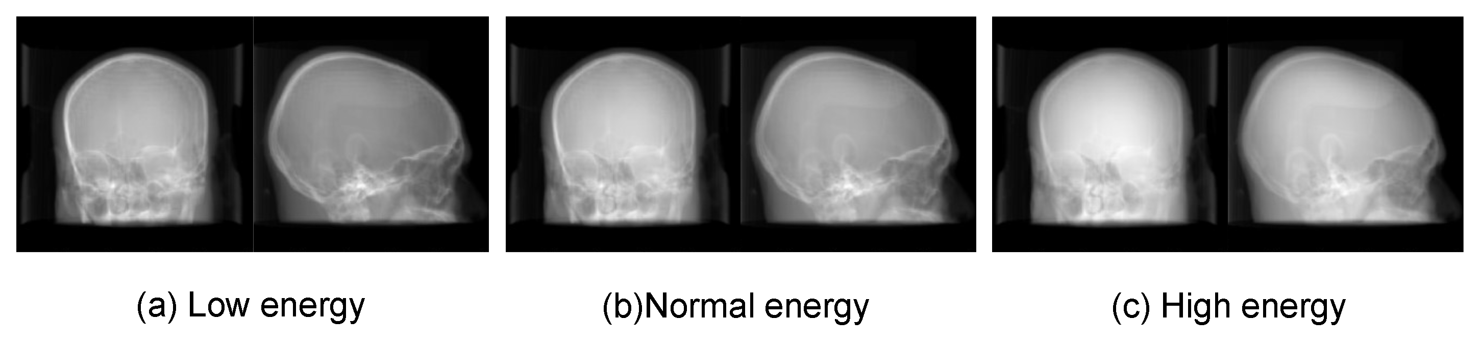Micromachines 12 00844 g011