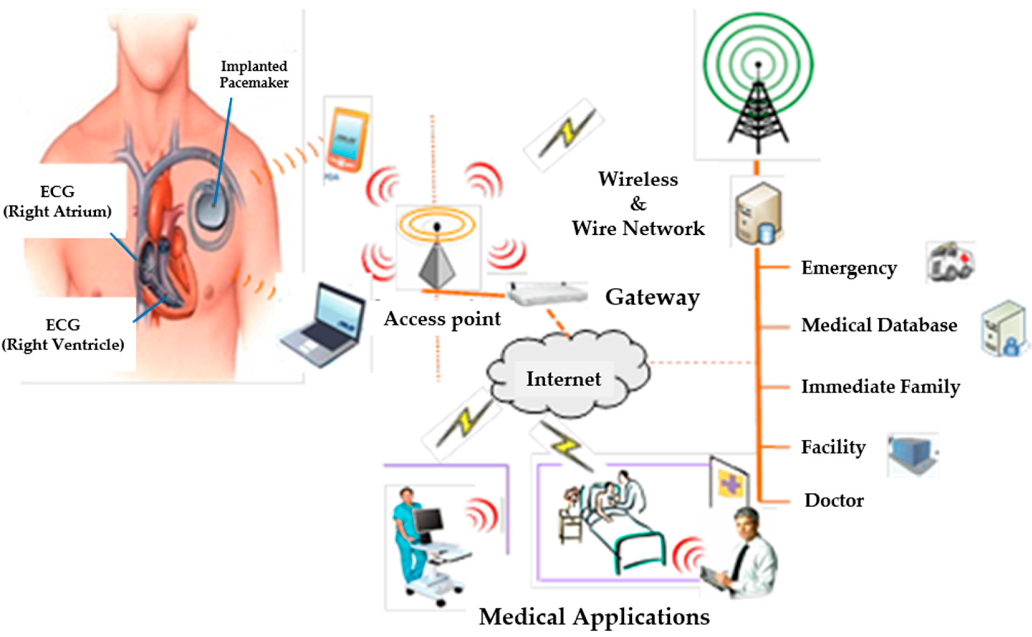 Wireless Smart Upper Arm Blood Pressure Monitor with Vital Eye Health