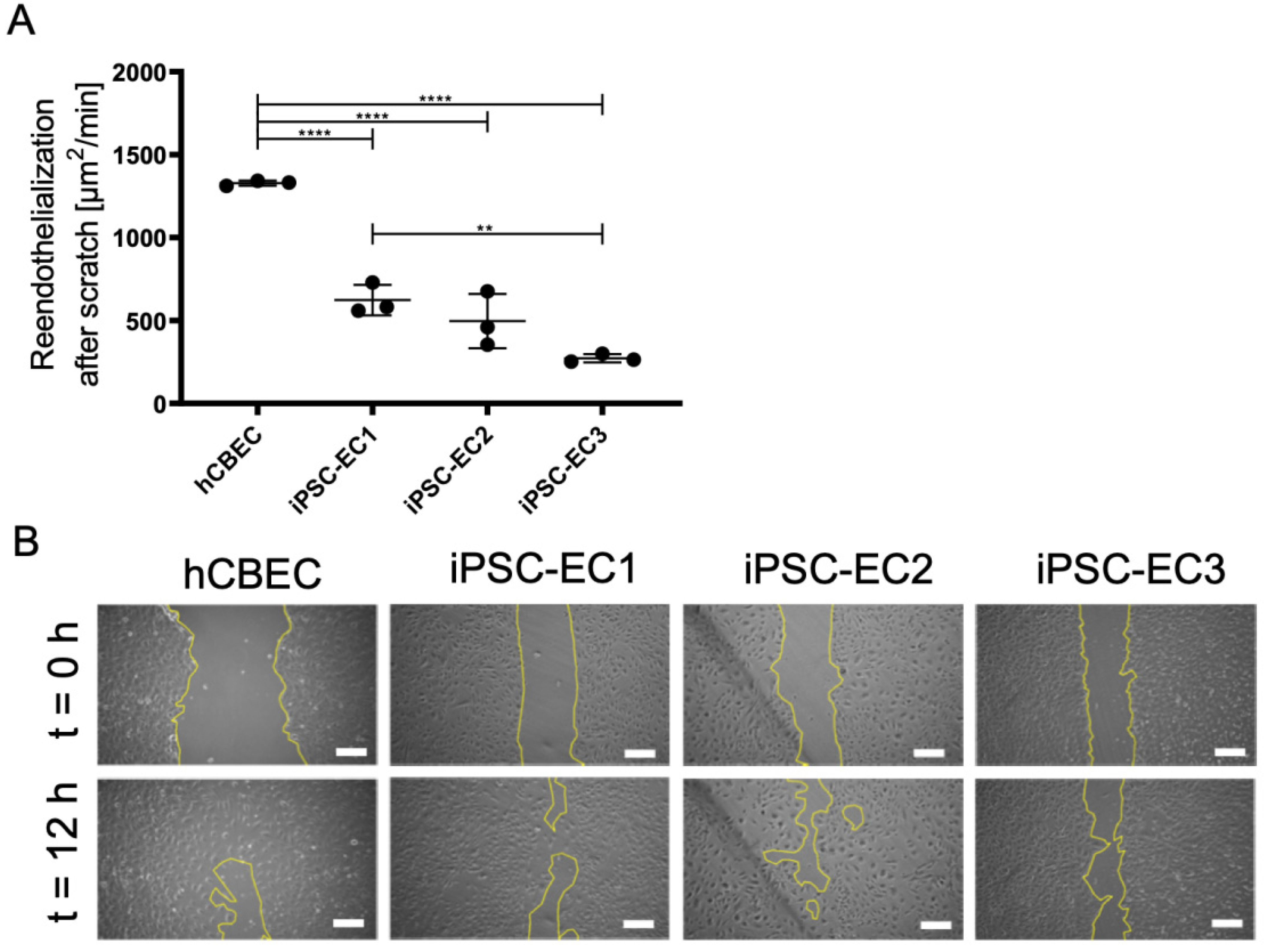Micromachines 12 00981 g005