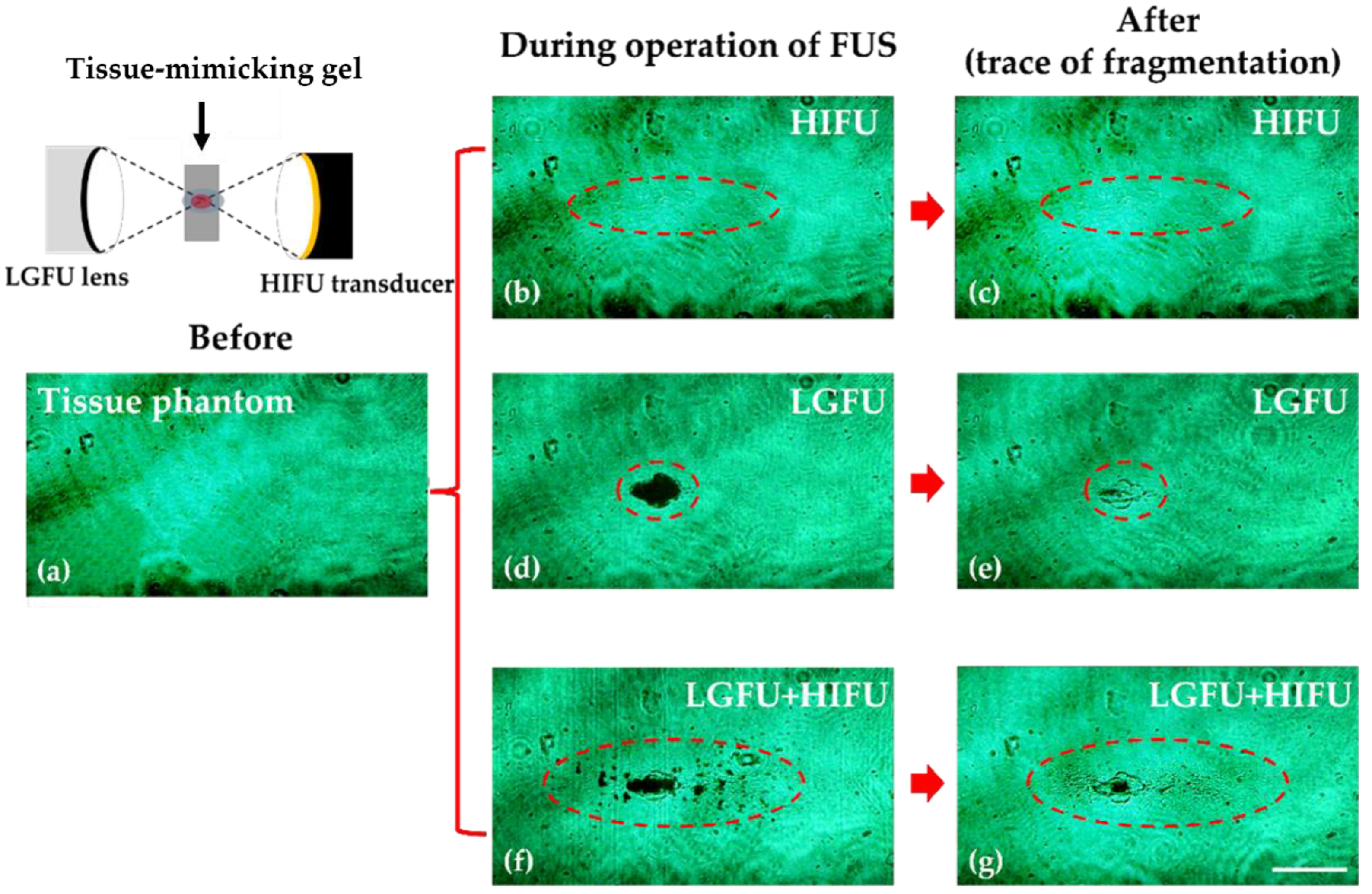 Micromachines 12 01268 g010 550