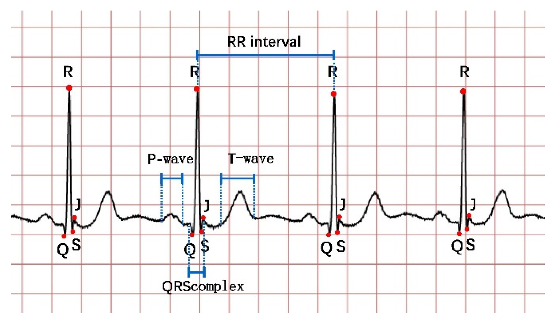 Micromachines 12 01282 g001 Micromachines 12 01282 g001