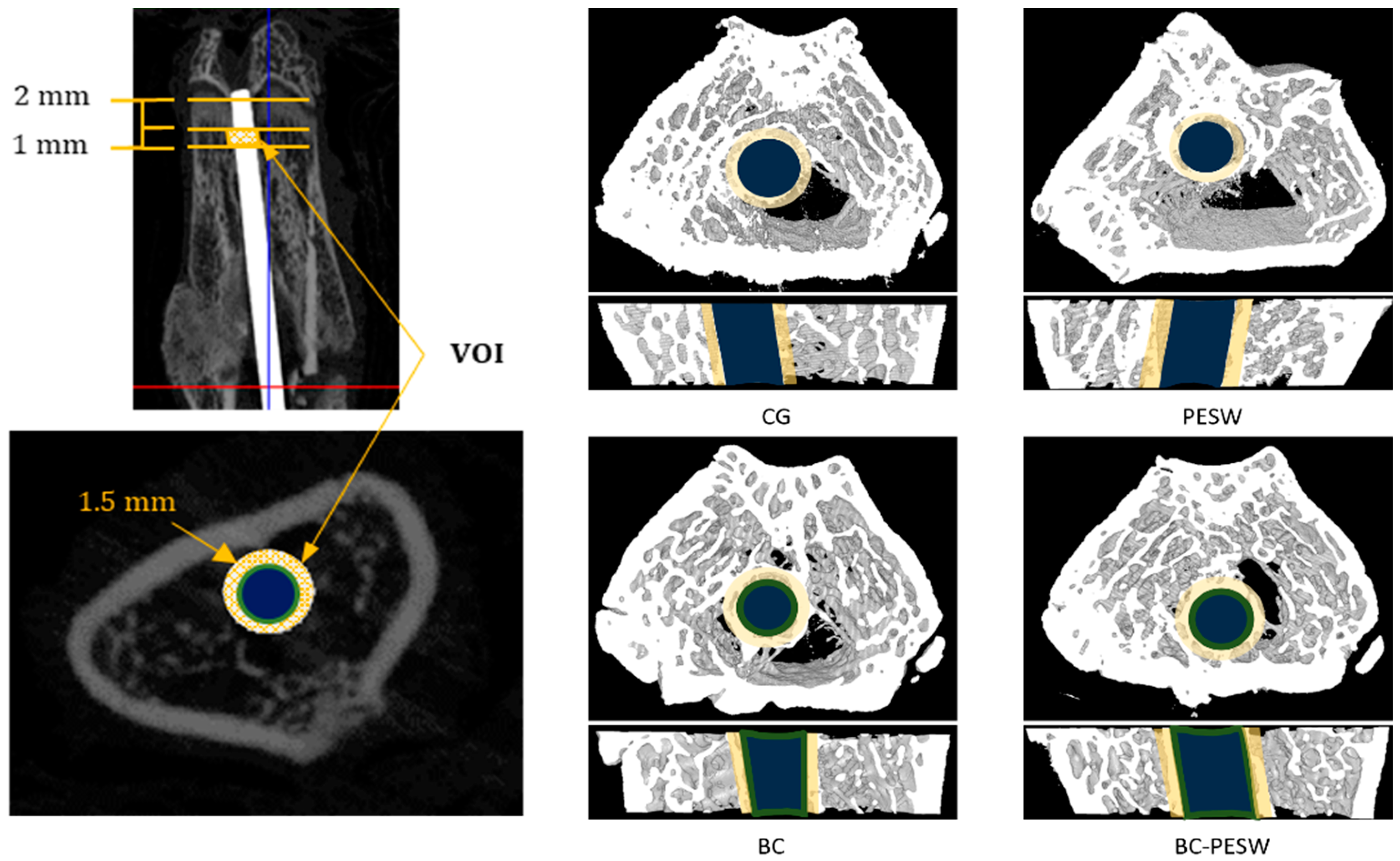 Micromachines 12 01352 g003 550