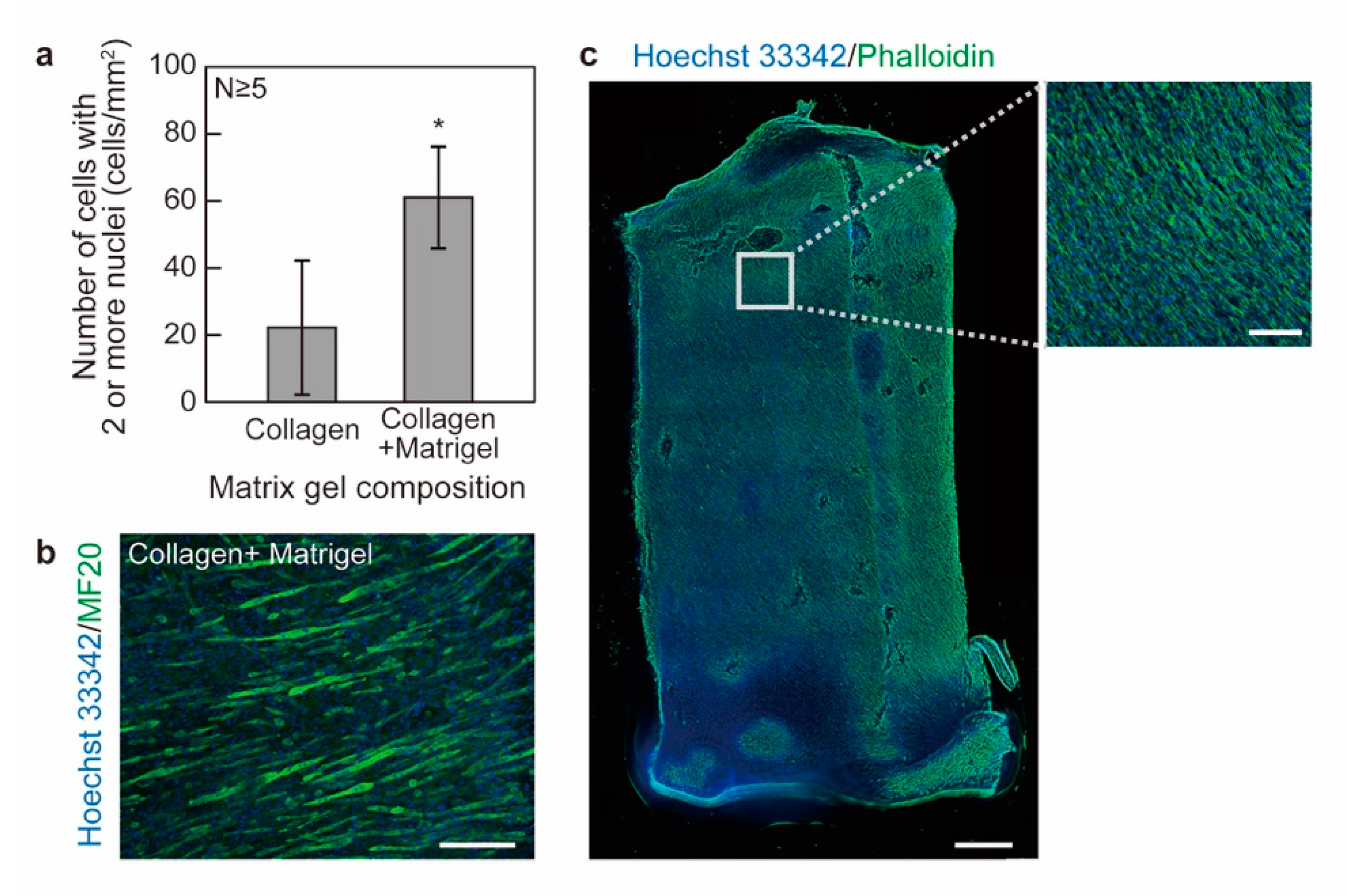 Micromachines 12 01411 g003