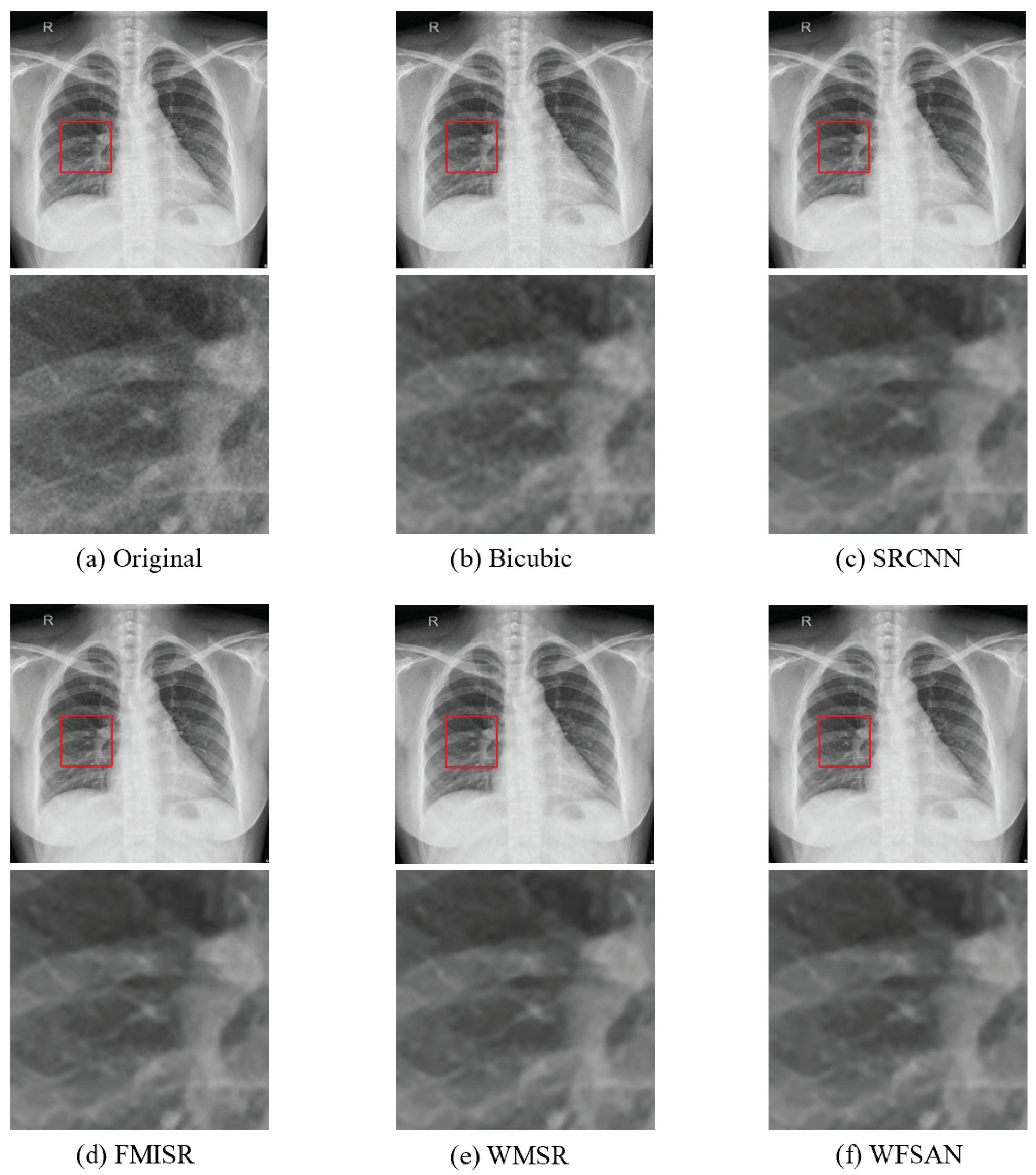 Micromachines 12 01418 g008
