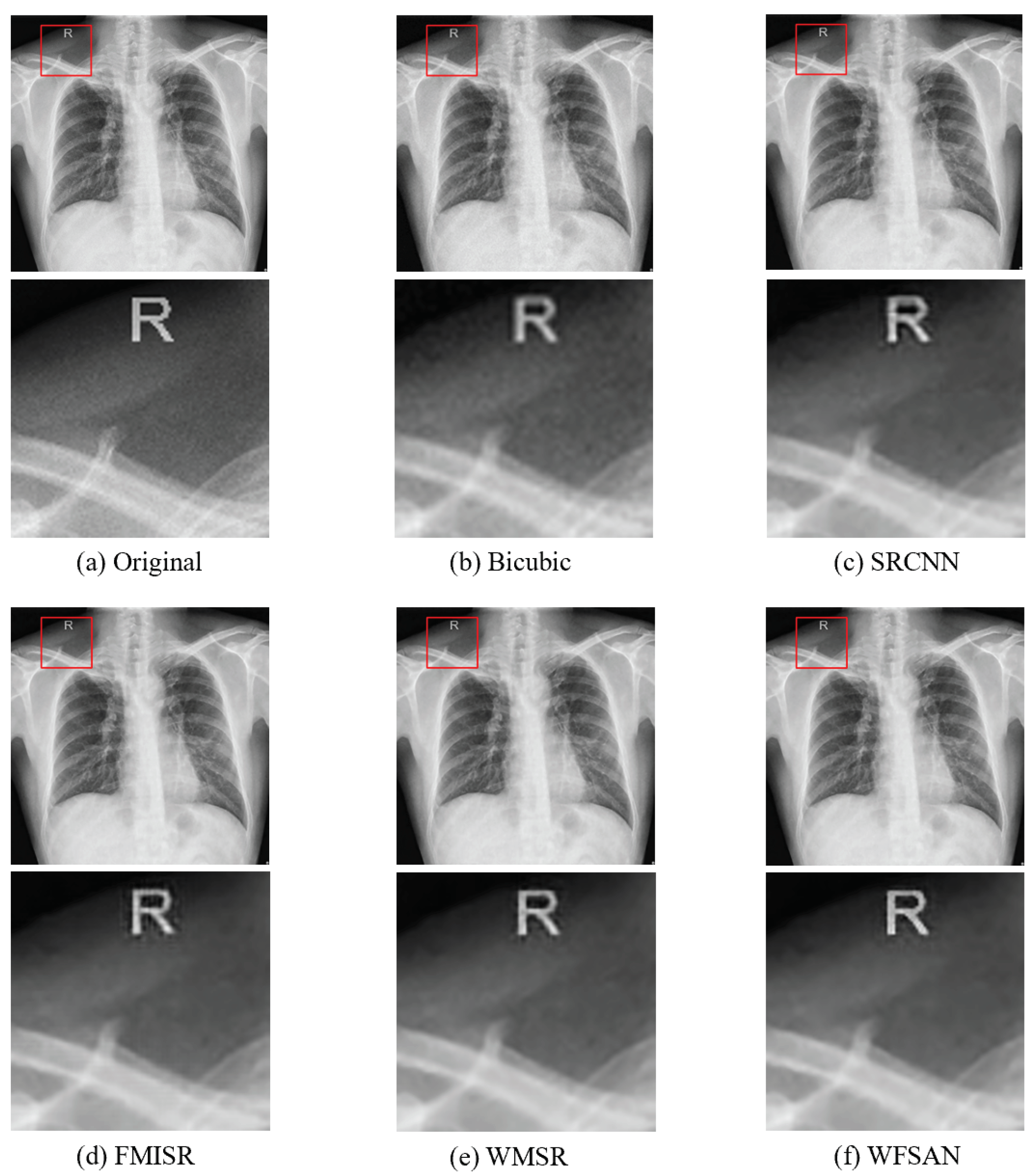 Micromachines 12 01418 g009