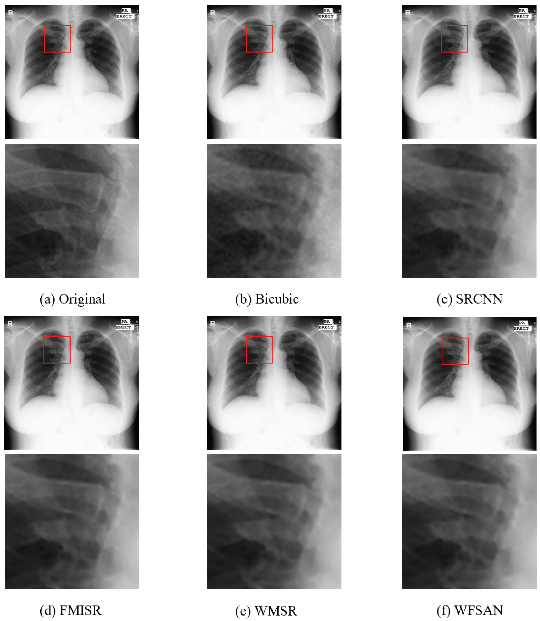 Micromachines 12 01418 g010