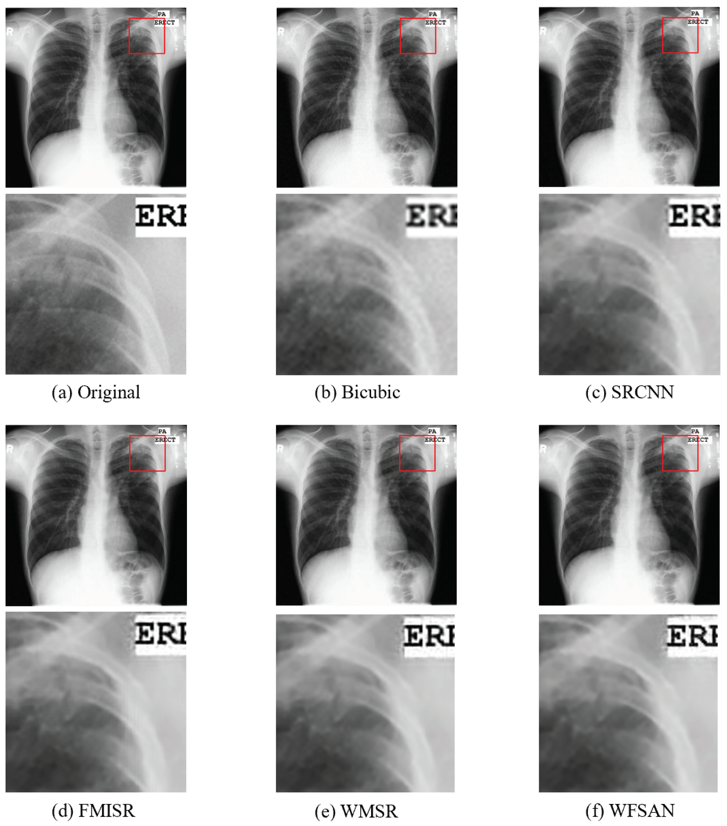 Micromachines 12 01418 g011