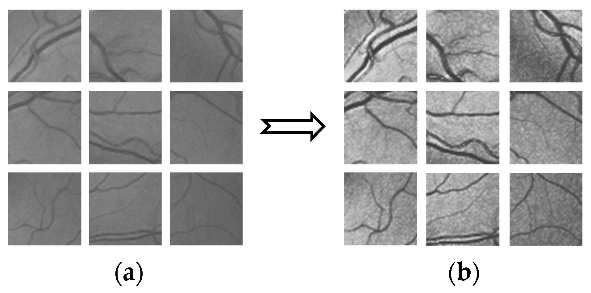 Micromachines 12 01478 g002 550