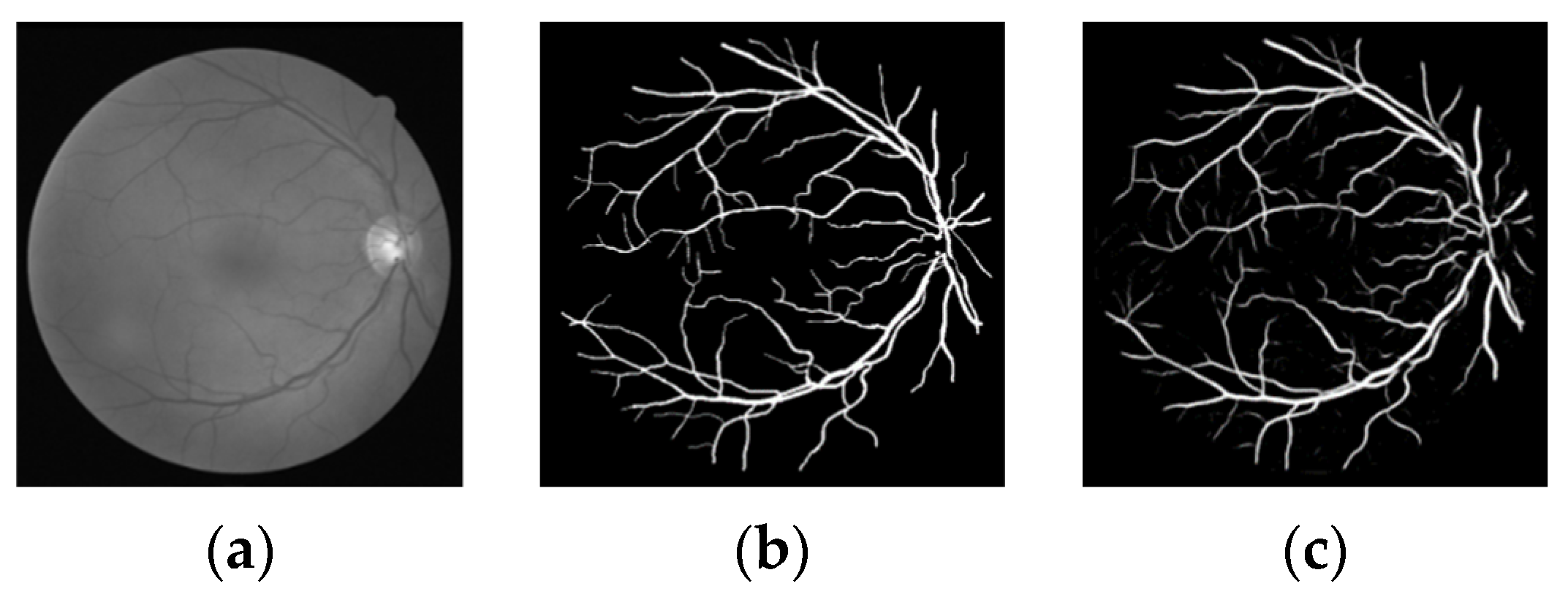 Micromachines 12 01478 g006 550